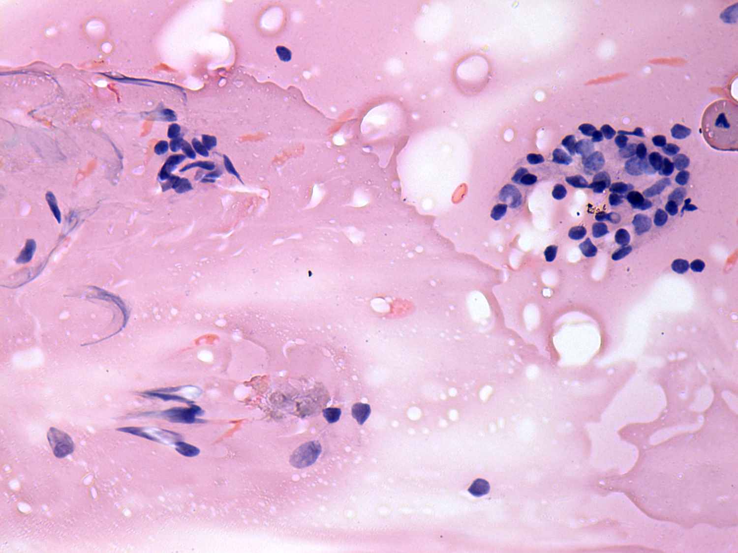 Right lobe, longitudinal scan