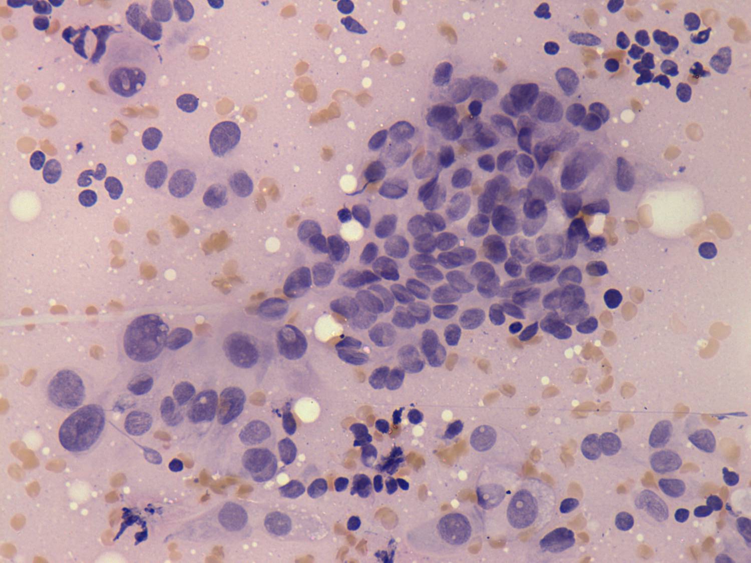 Right lobe, longitudinal scan