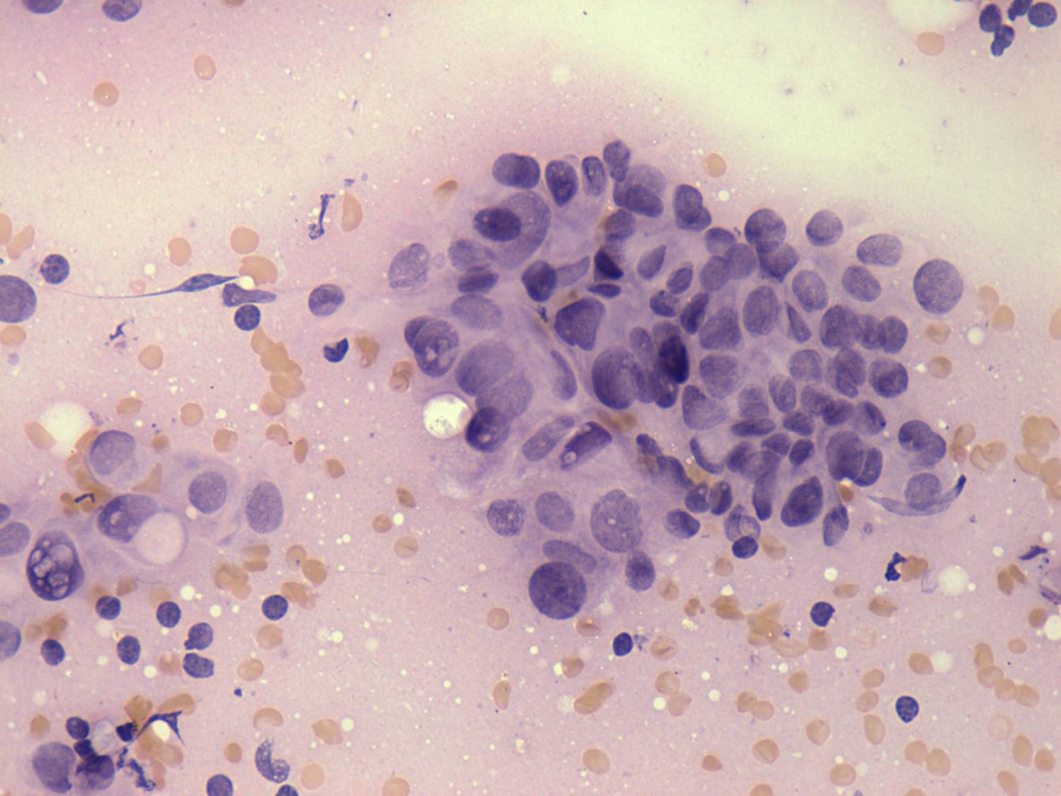 Right lobe, longitudinal scan