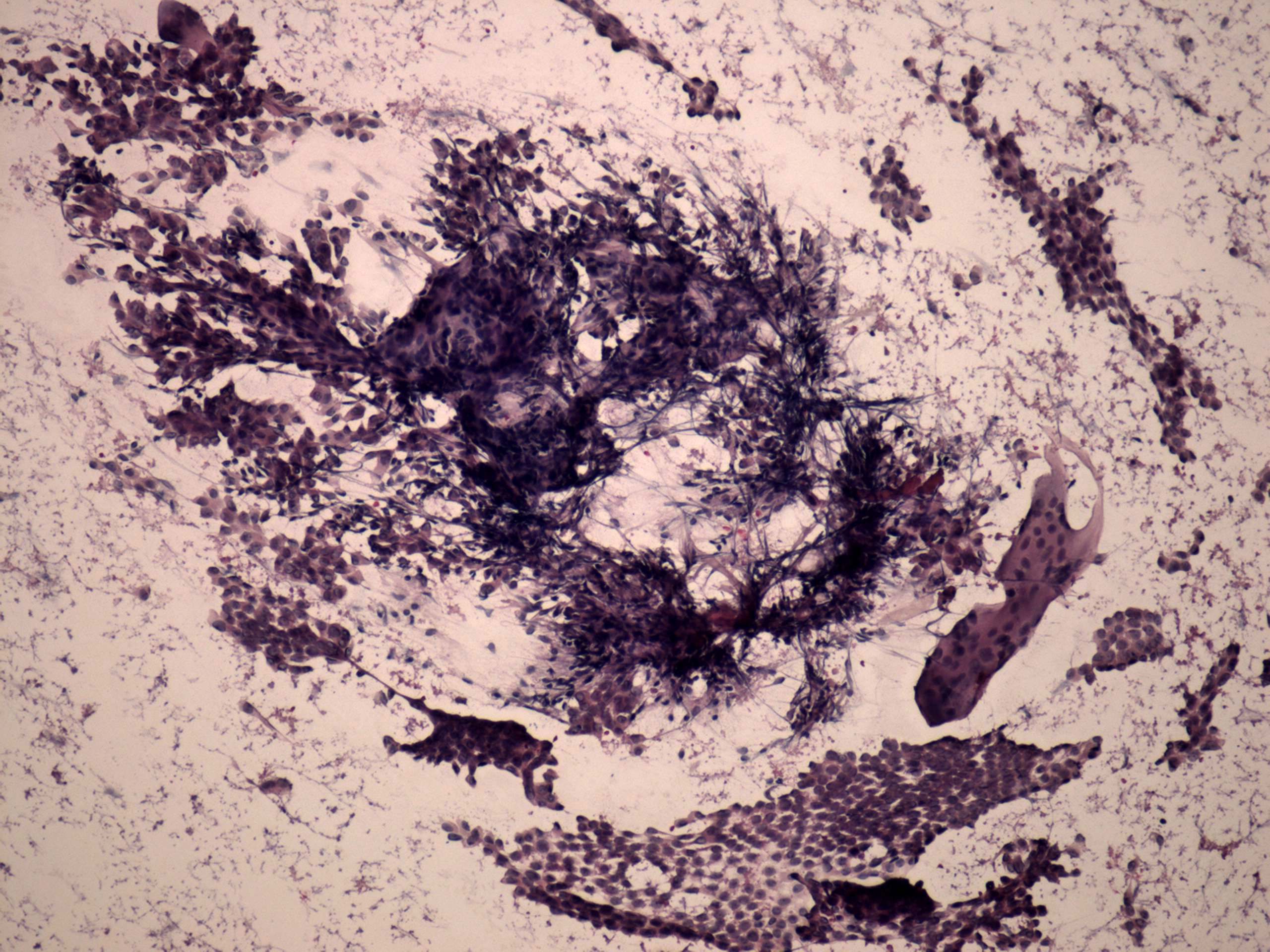Right lobe, longitudinal scan
