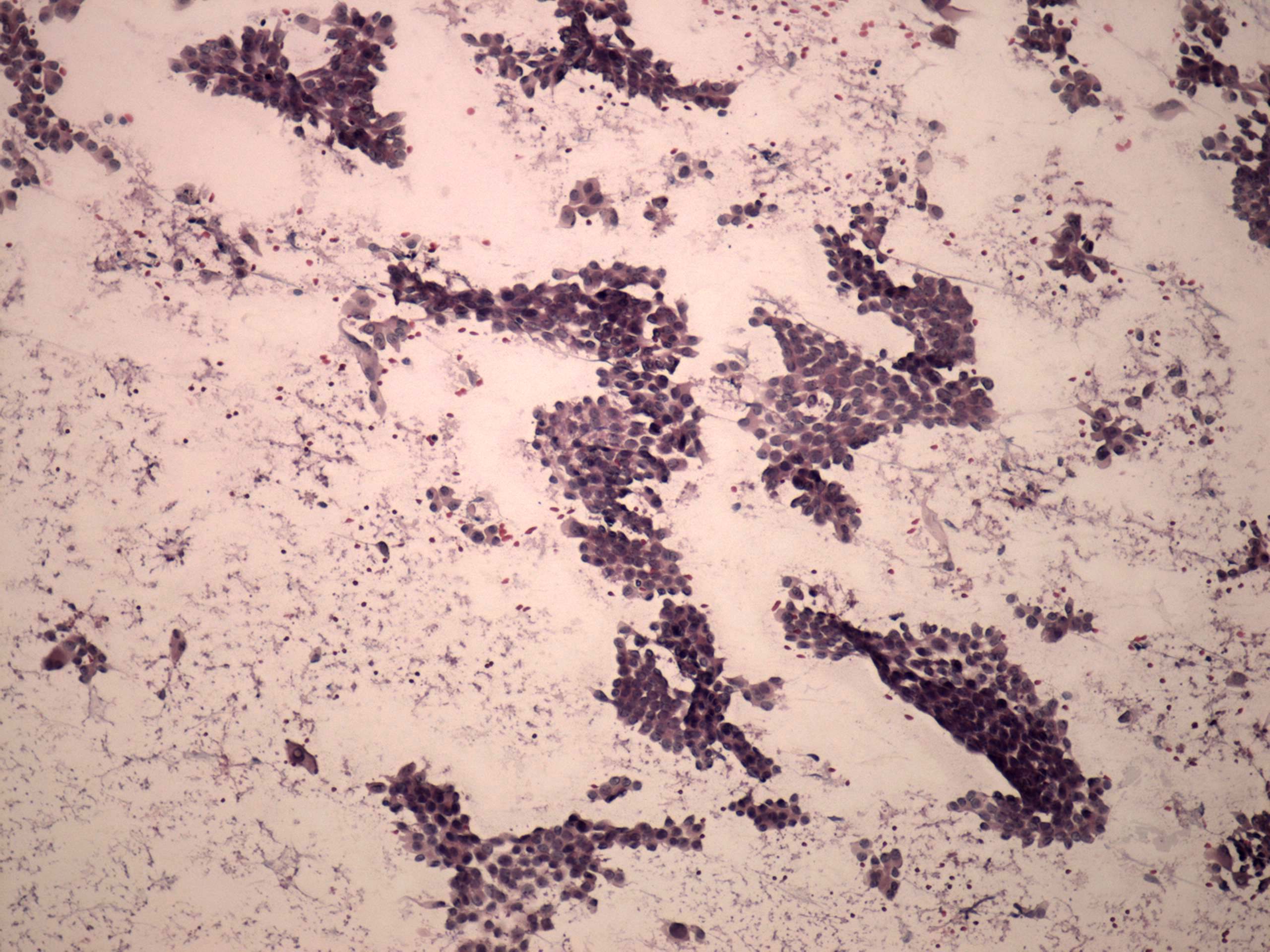 Right lobe, longitudinal scan