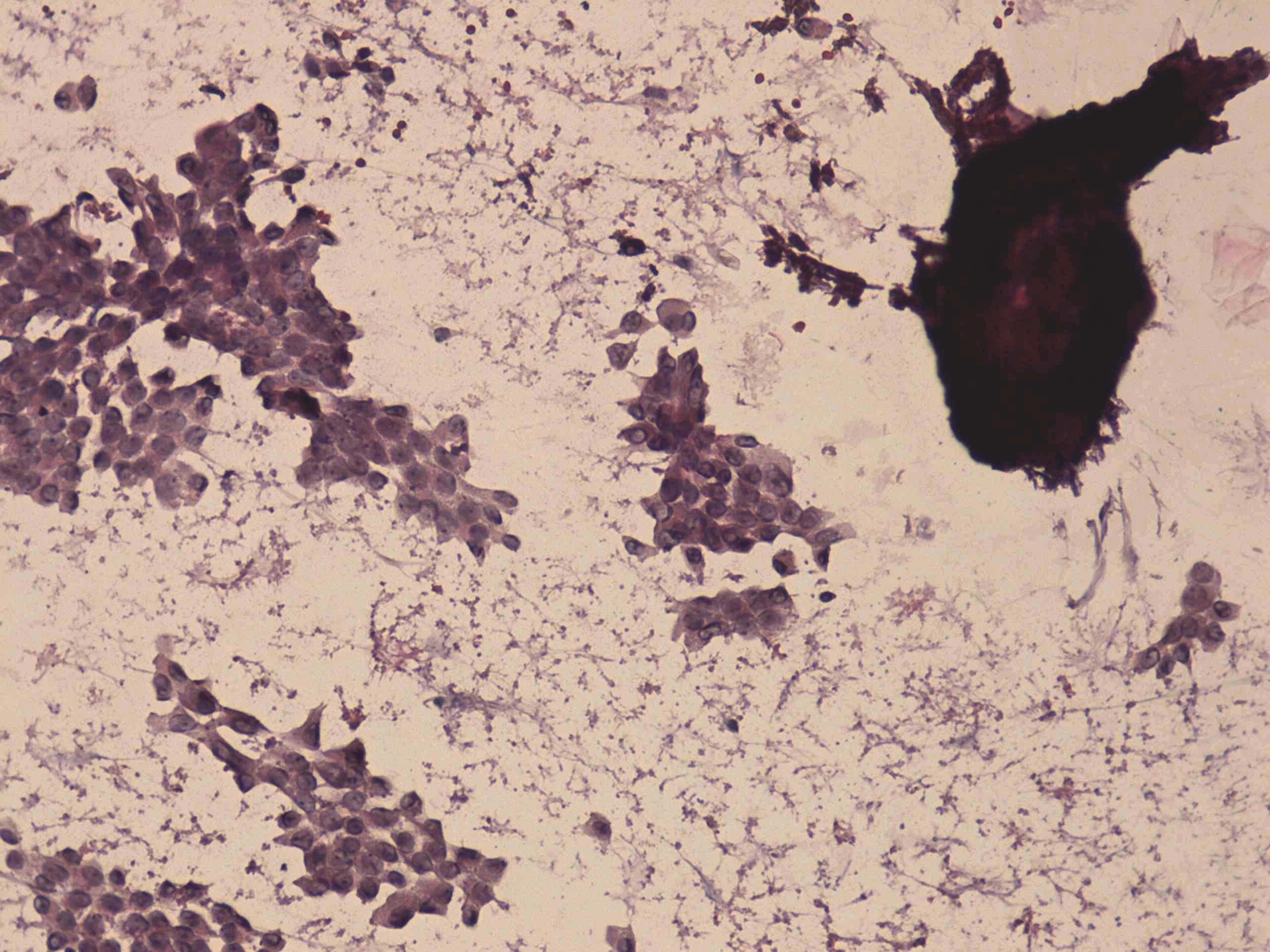 Right lobe, longitudinal scan