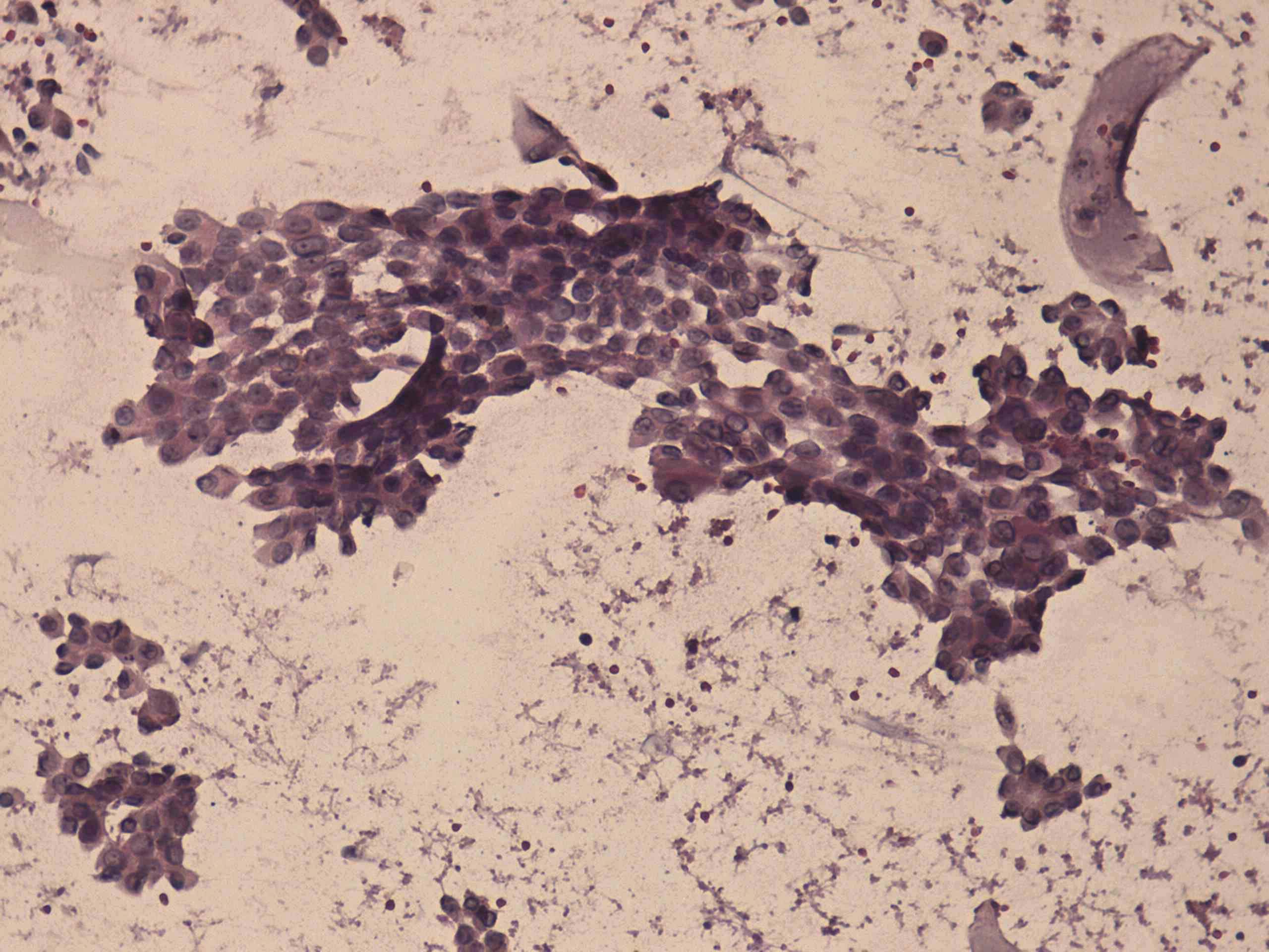 Right lobe, longitudinal scan