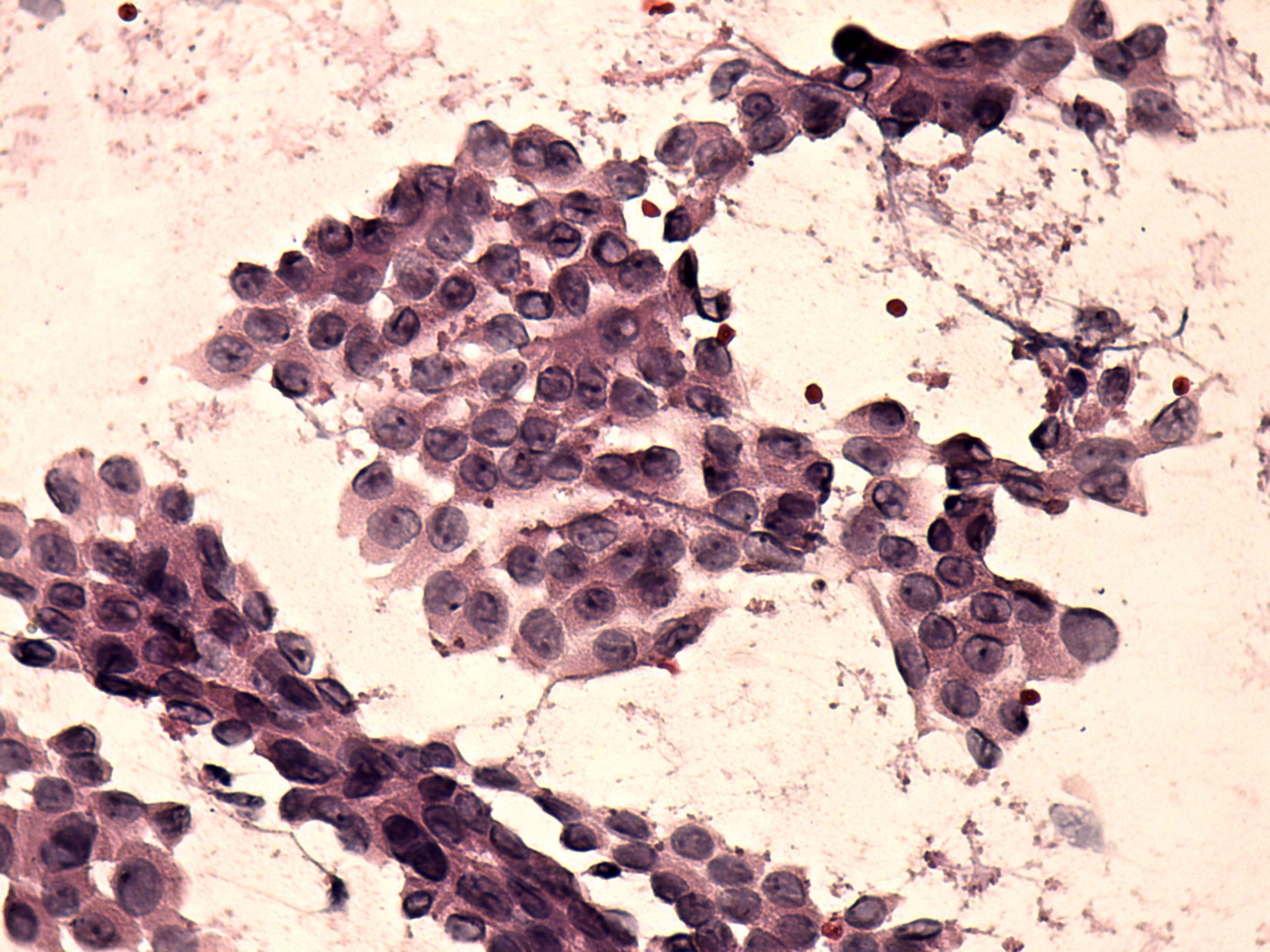 Right lobe, longitudinal scan