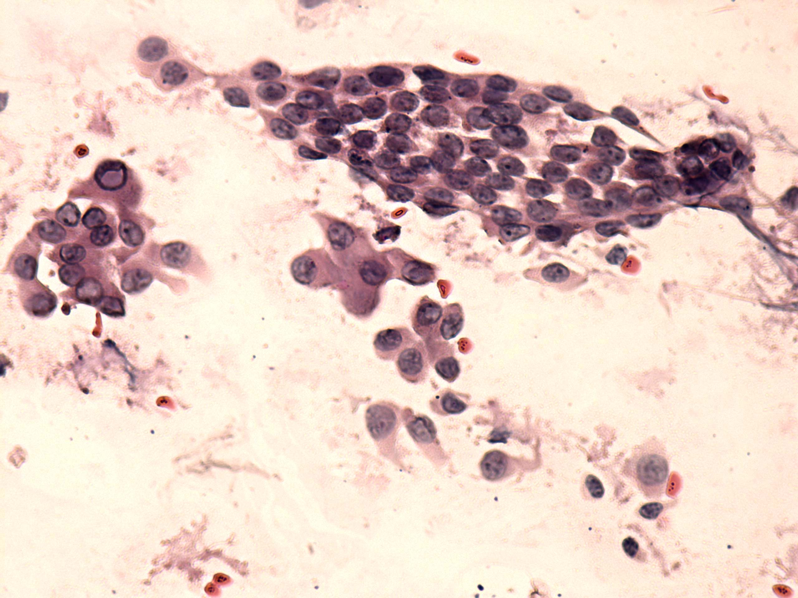 Right lobe, longitudinal scan