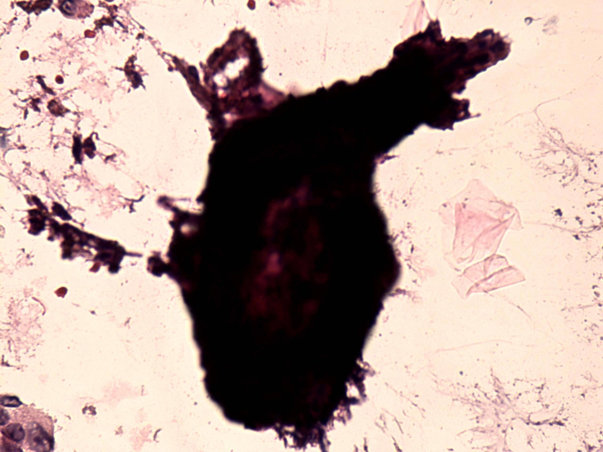 Right lobe, longitudinal scan