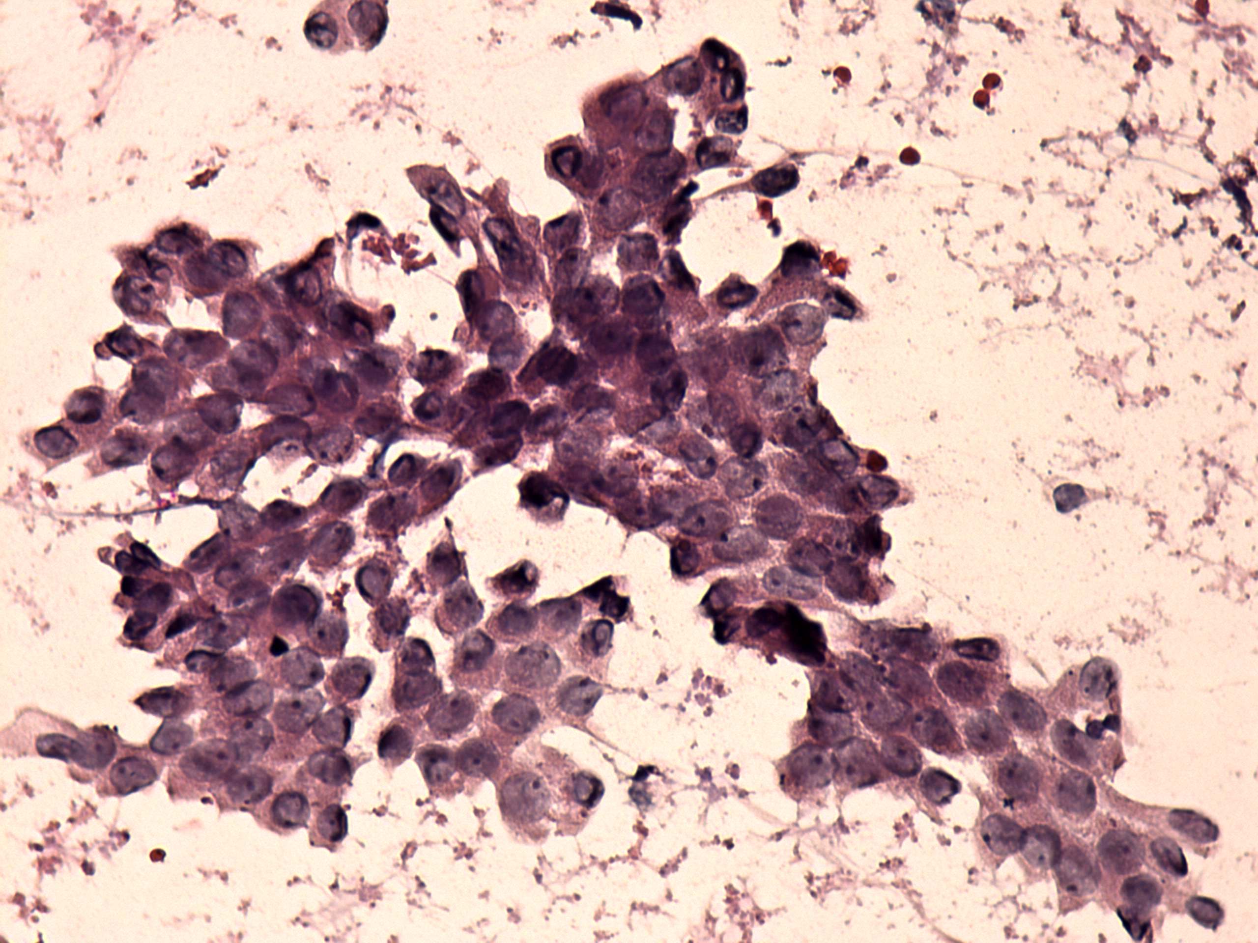 Right lobe, longitudinal scan