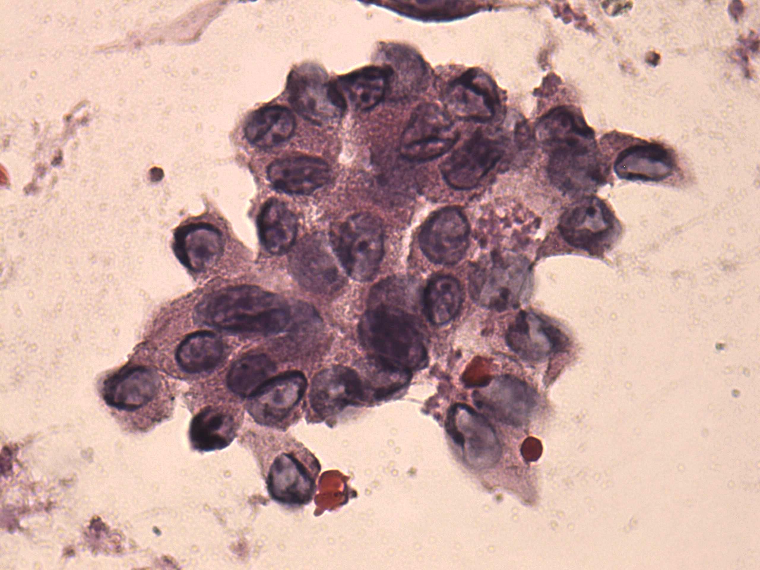 Right lobe, longitudinal scan