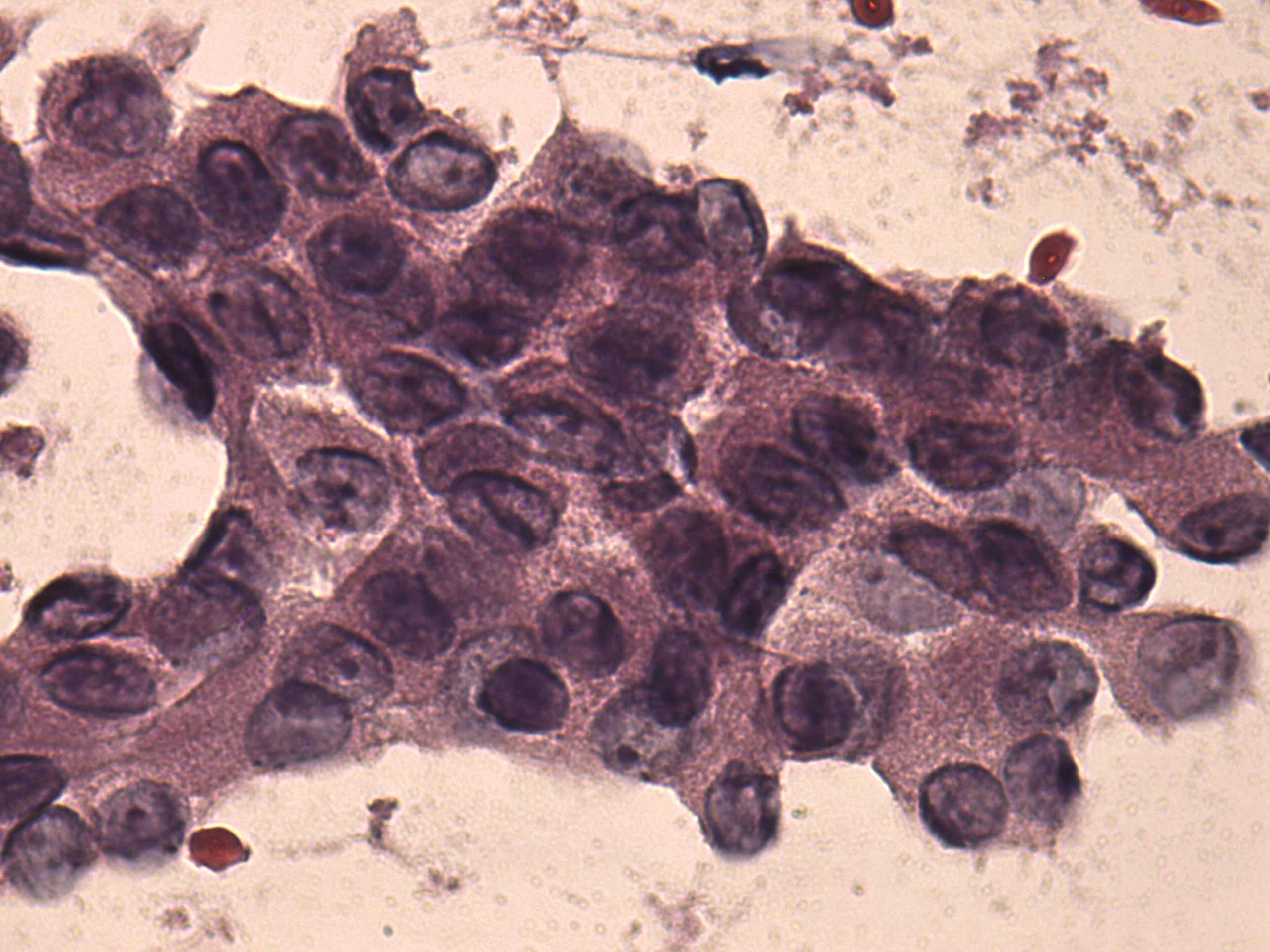 Right lobe, longitudinal scan
