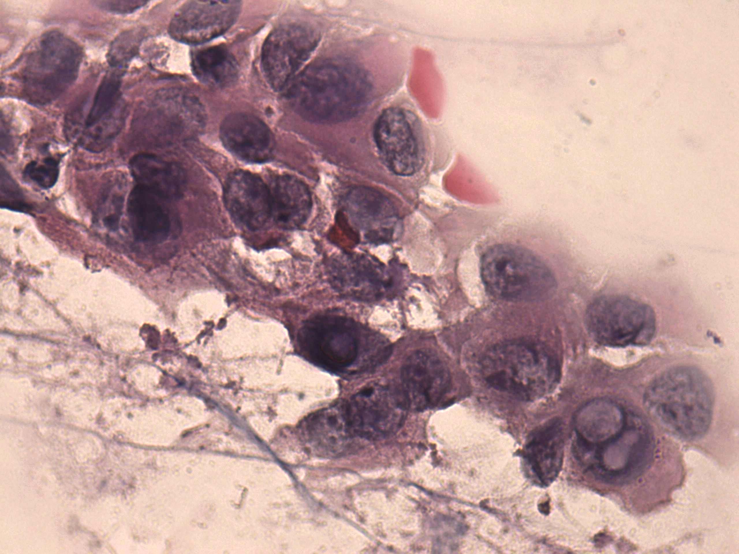 Right lobe, longitudinal scan