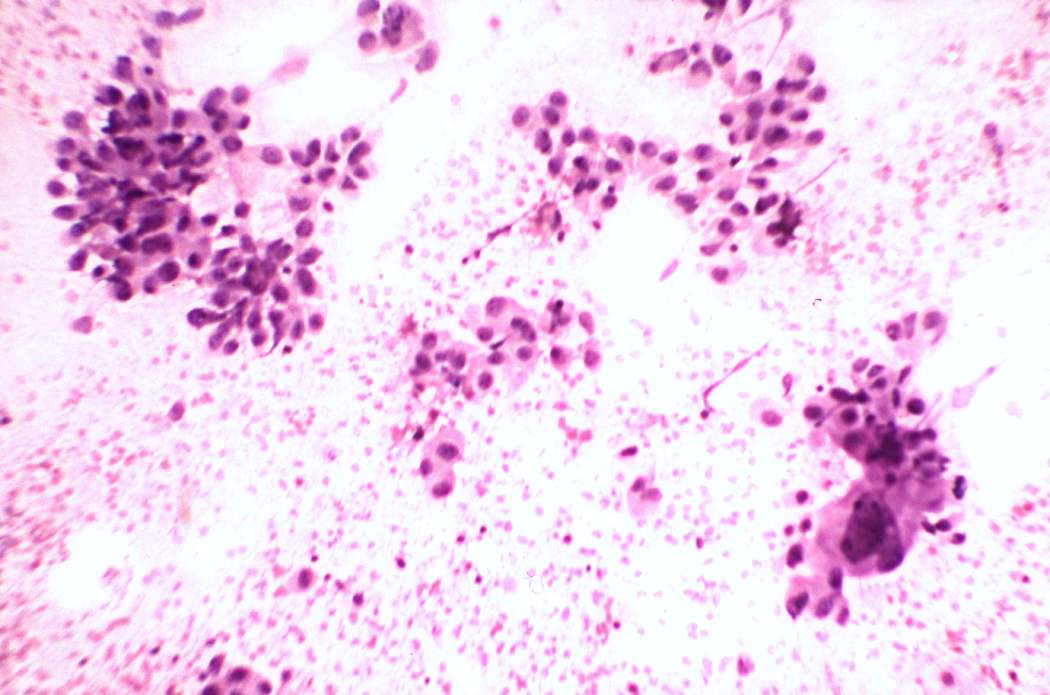Right lobe, longitudinal scan