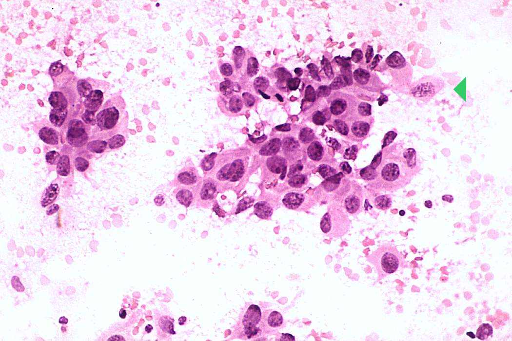 Right lobe, longitudinal scan