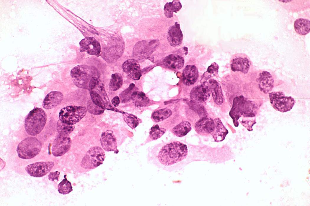 Right lobe, longitudinal scan