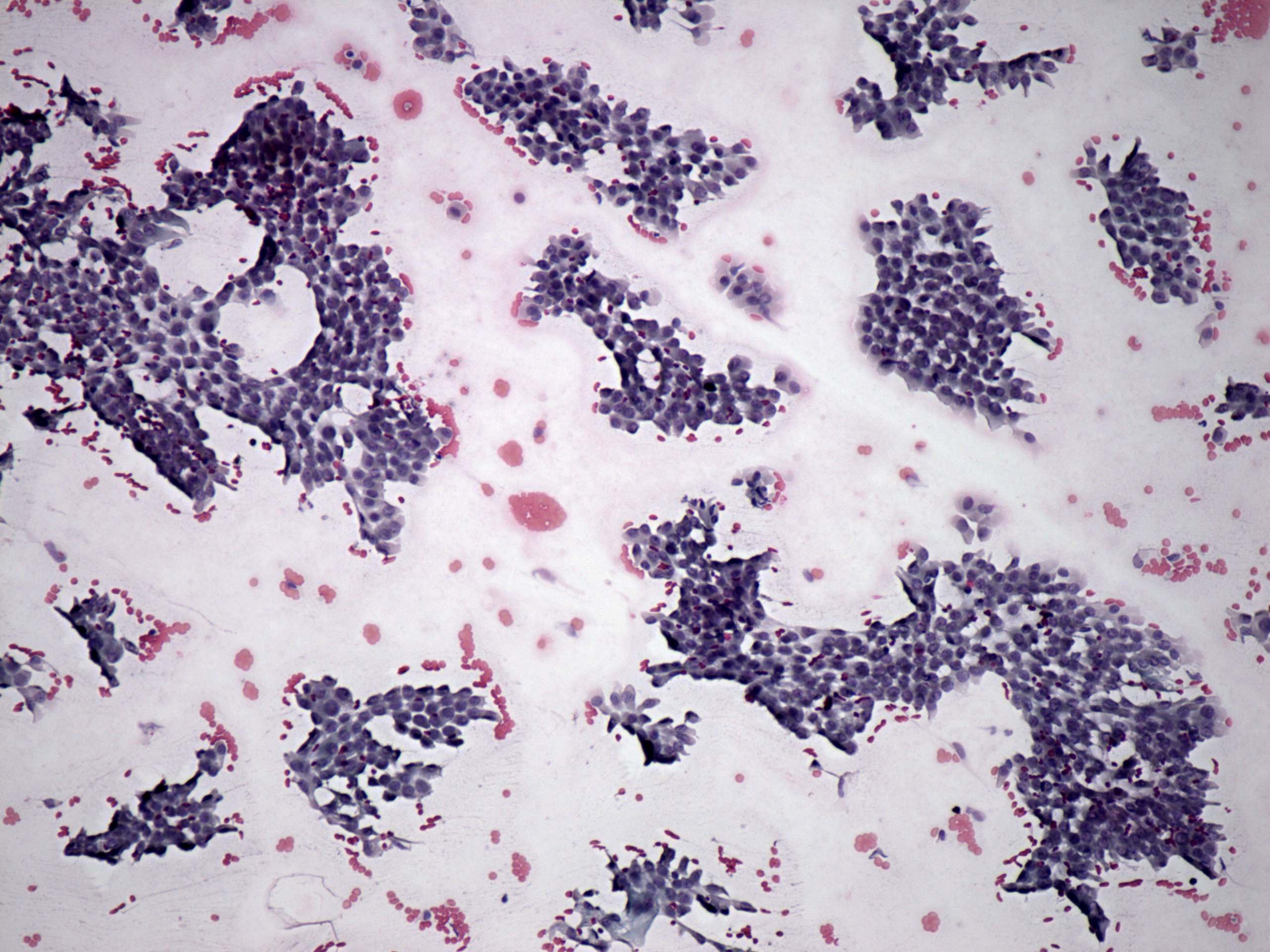 Right lobe, longitudinal scan