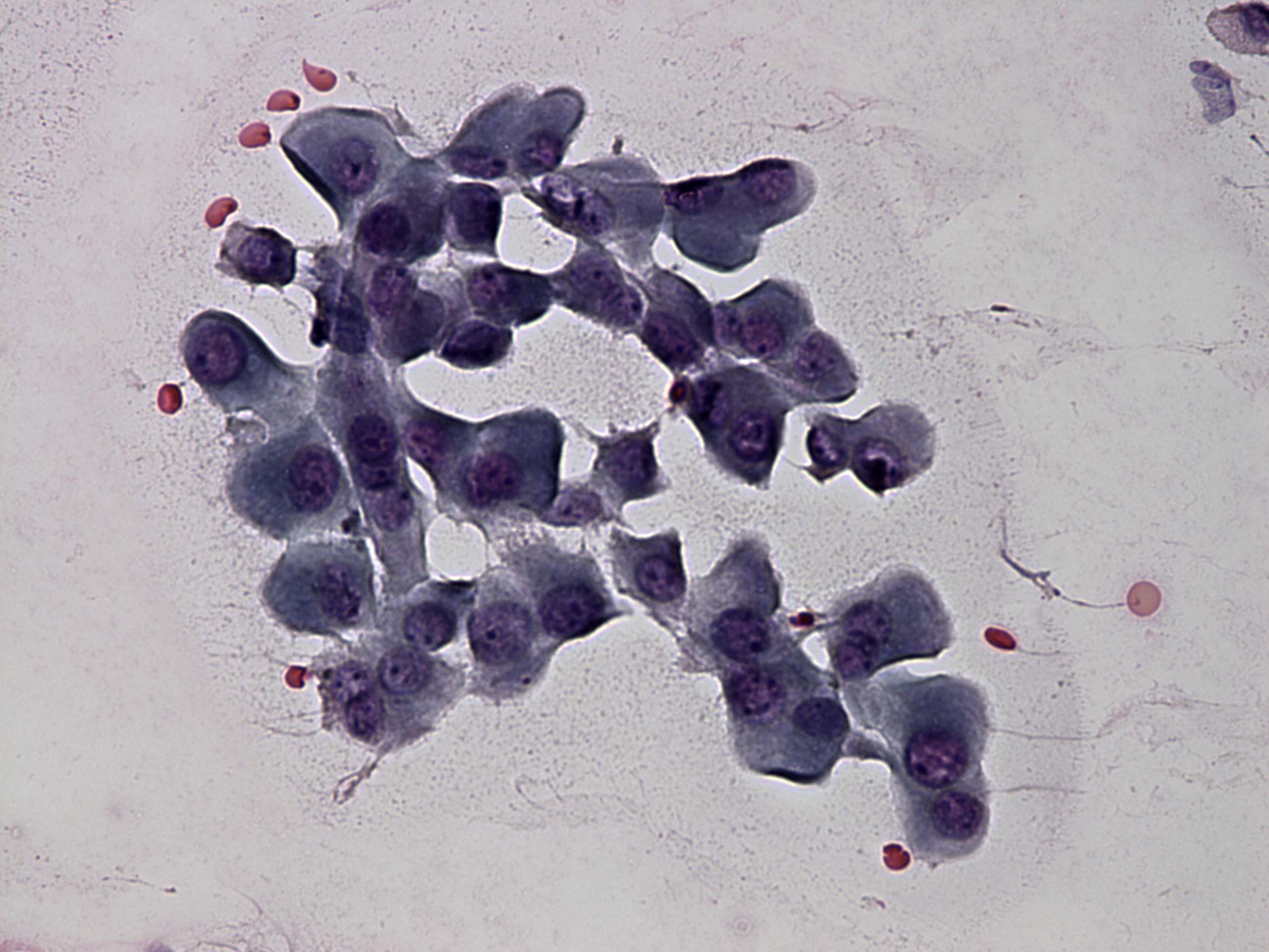 Right lobe, longitudinal scan