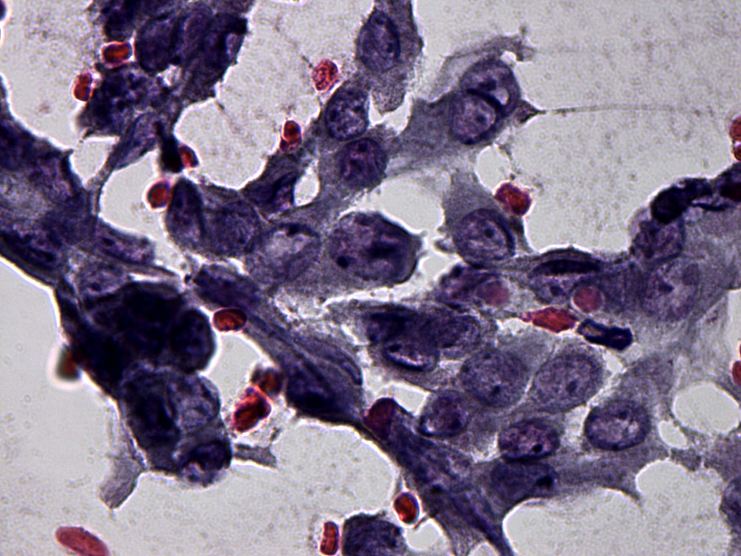Right lobe, longitudinal scan