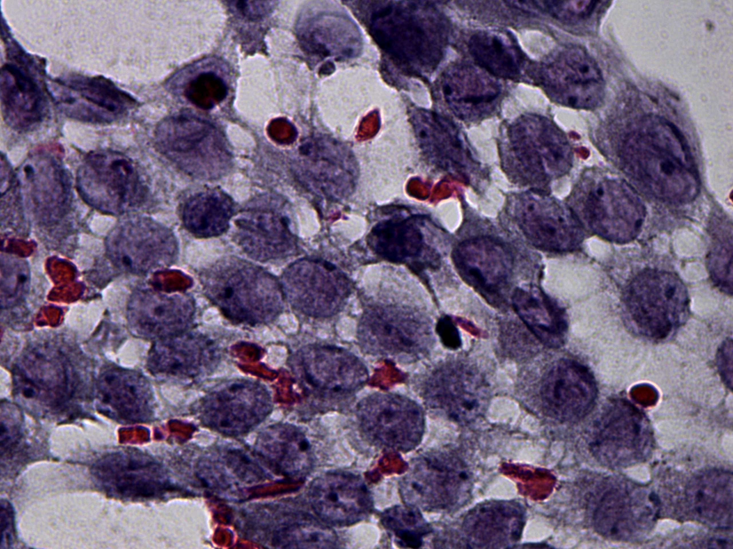Right lobe, longitudinal scan