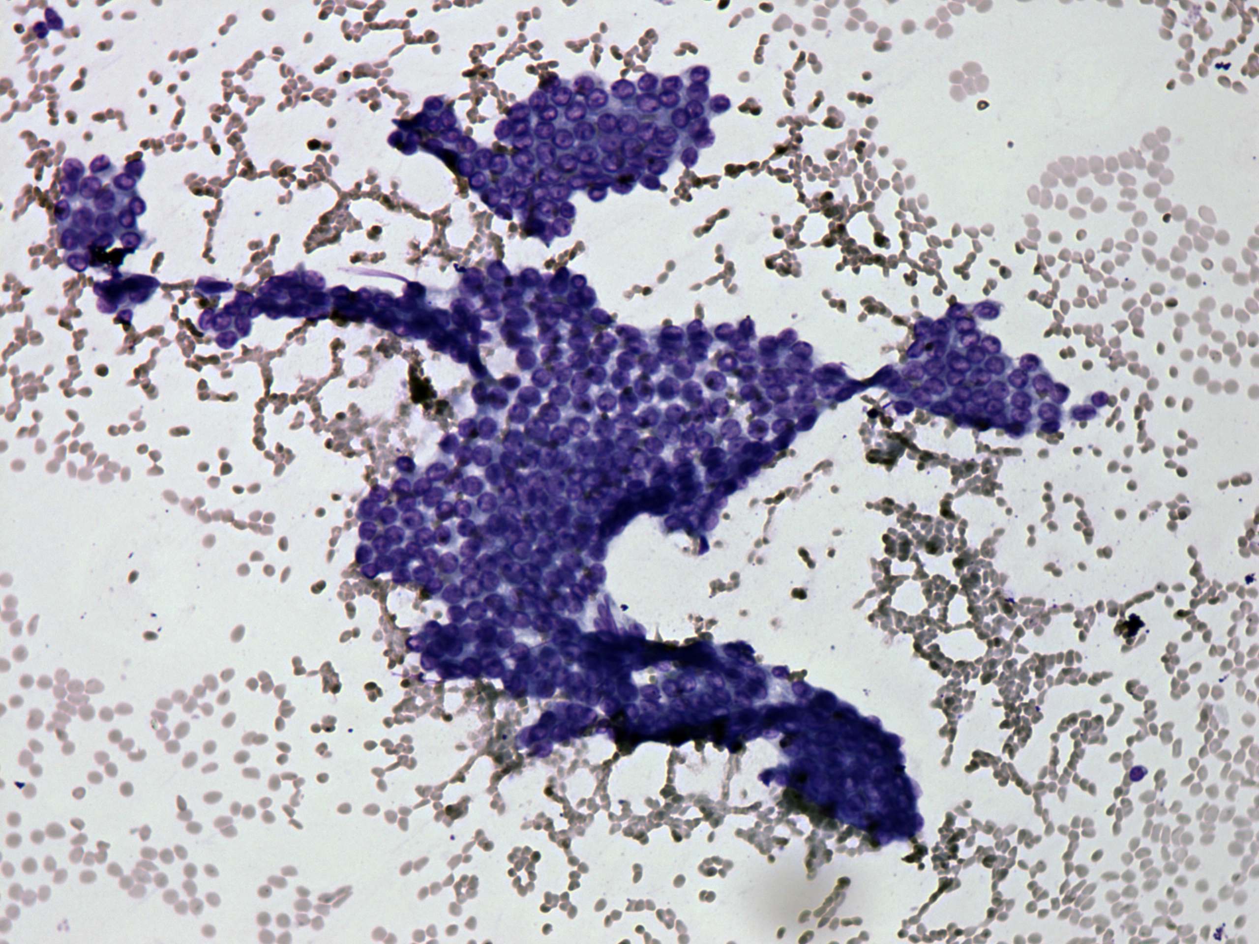 Right lobe, longitudinal scan