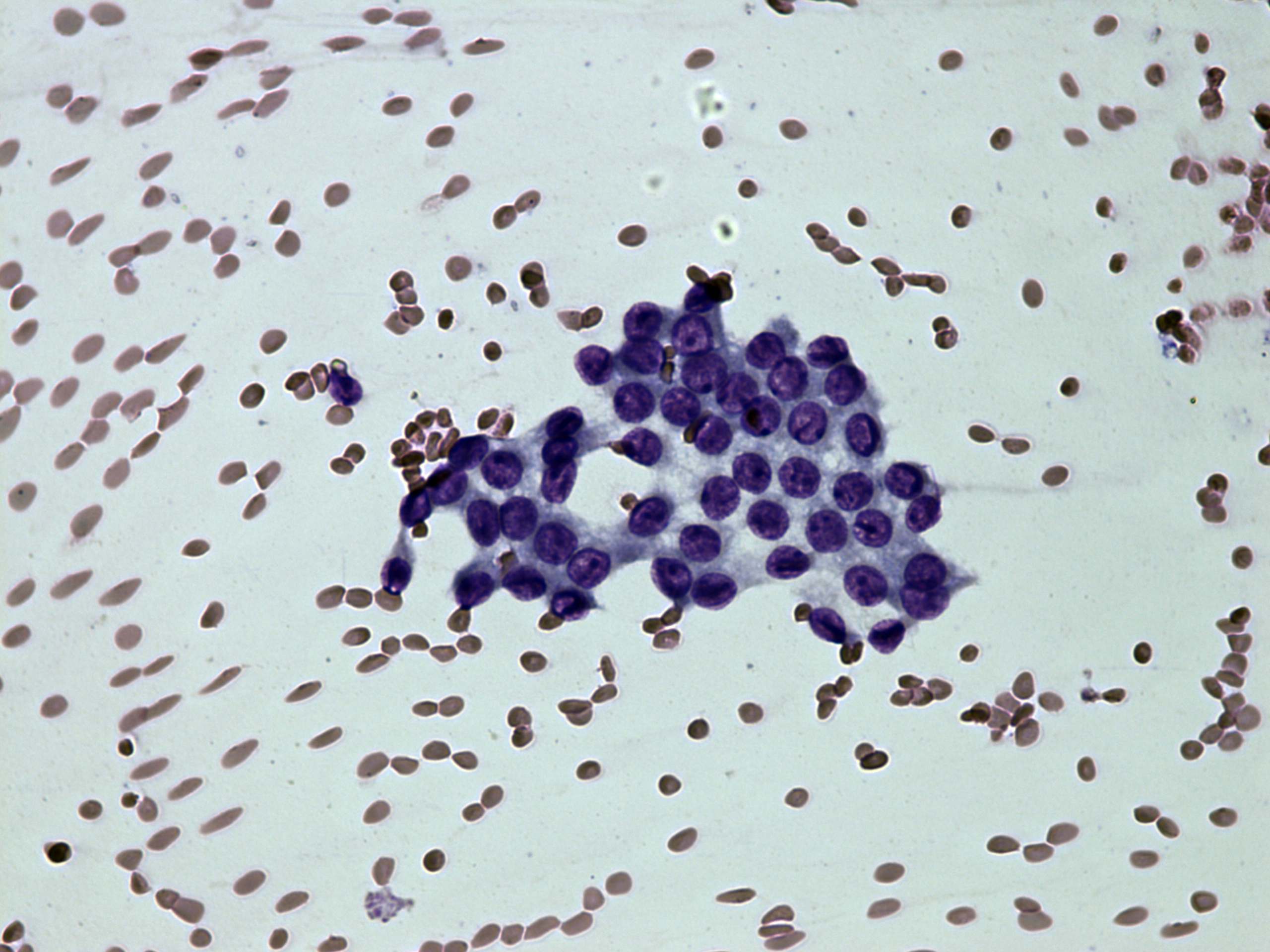 Right lobe, longitudinal scan