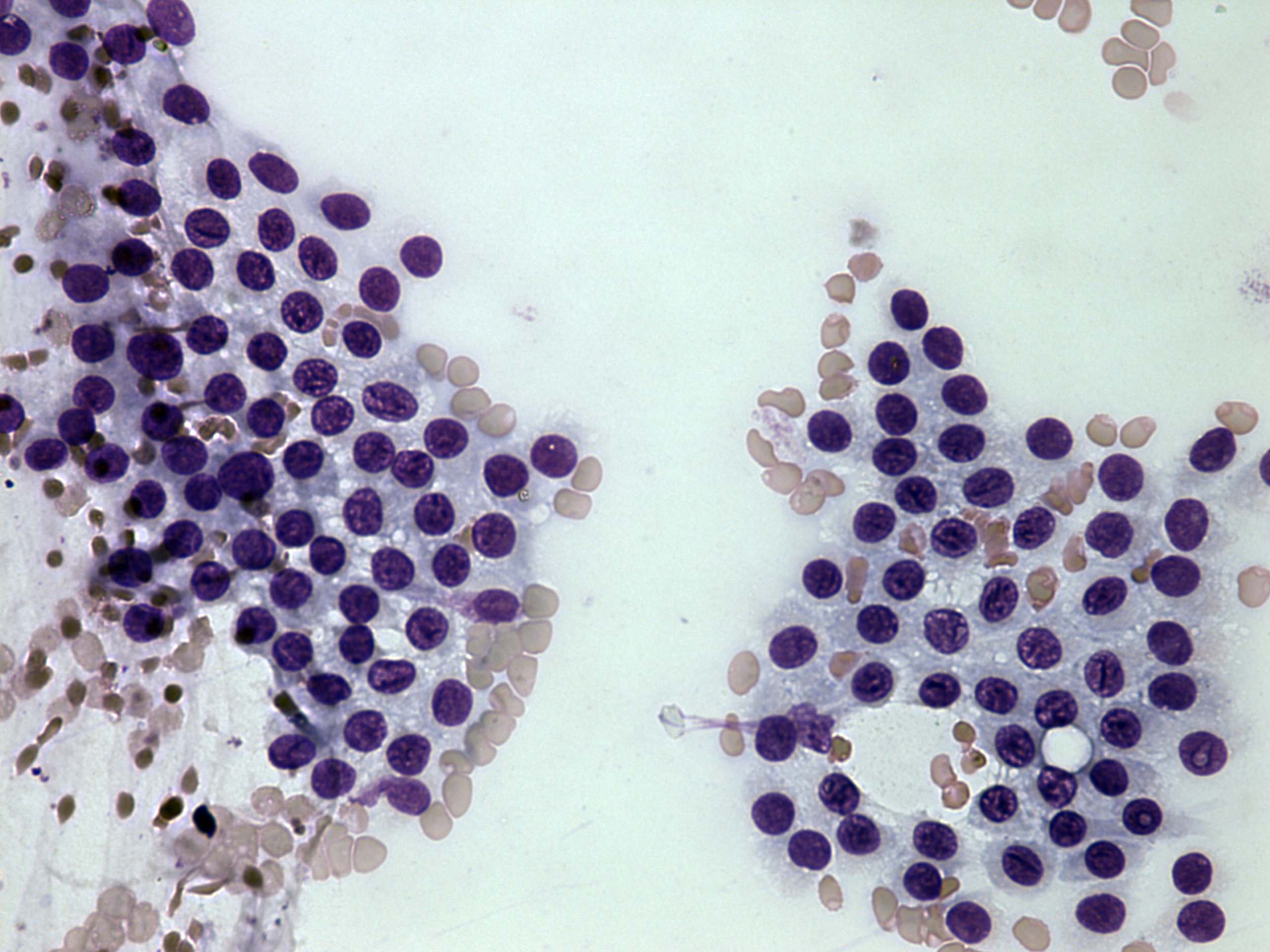 Right lobe, longitudinal scan