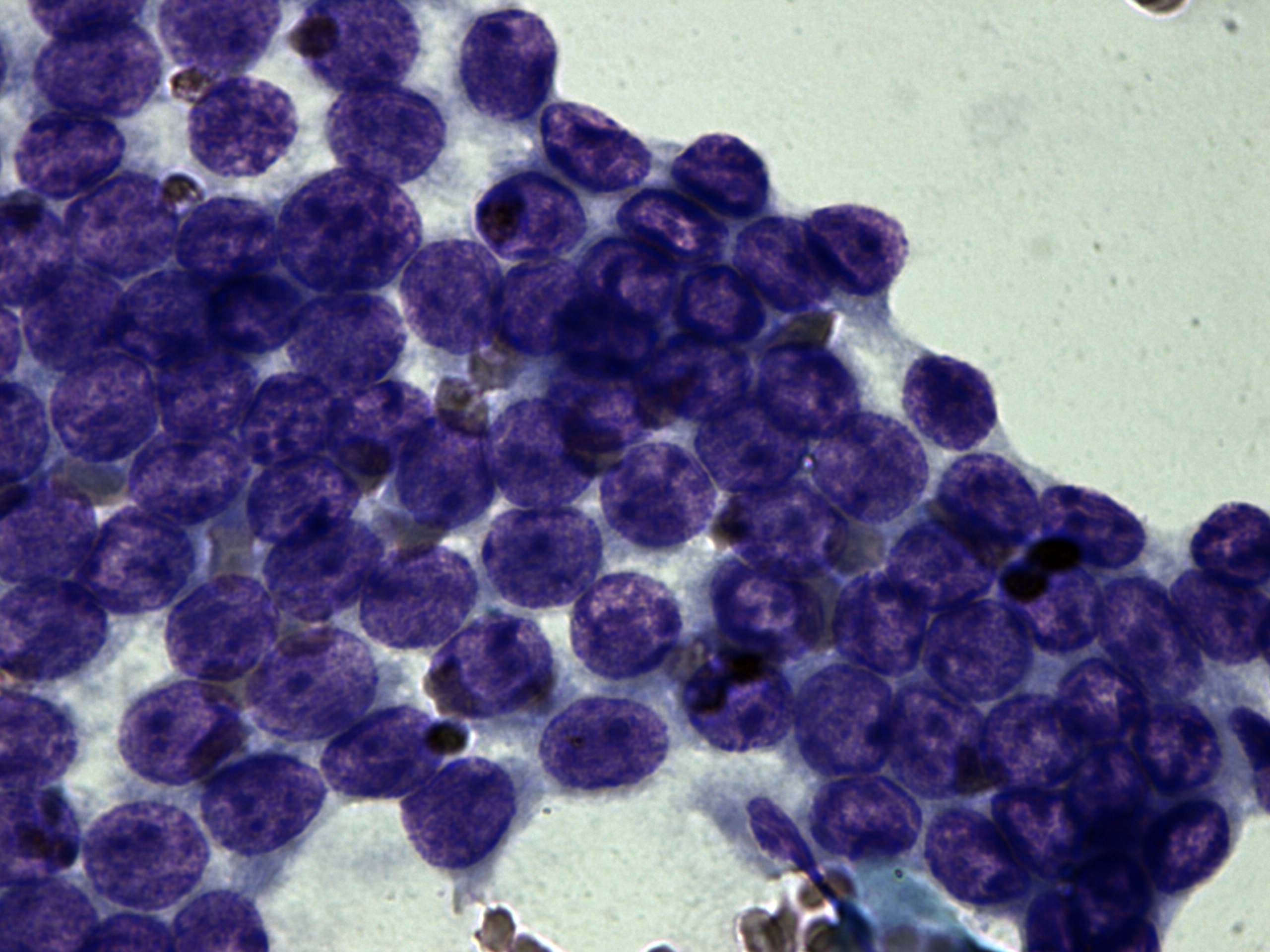 Right lobe, longitudinal scan