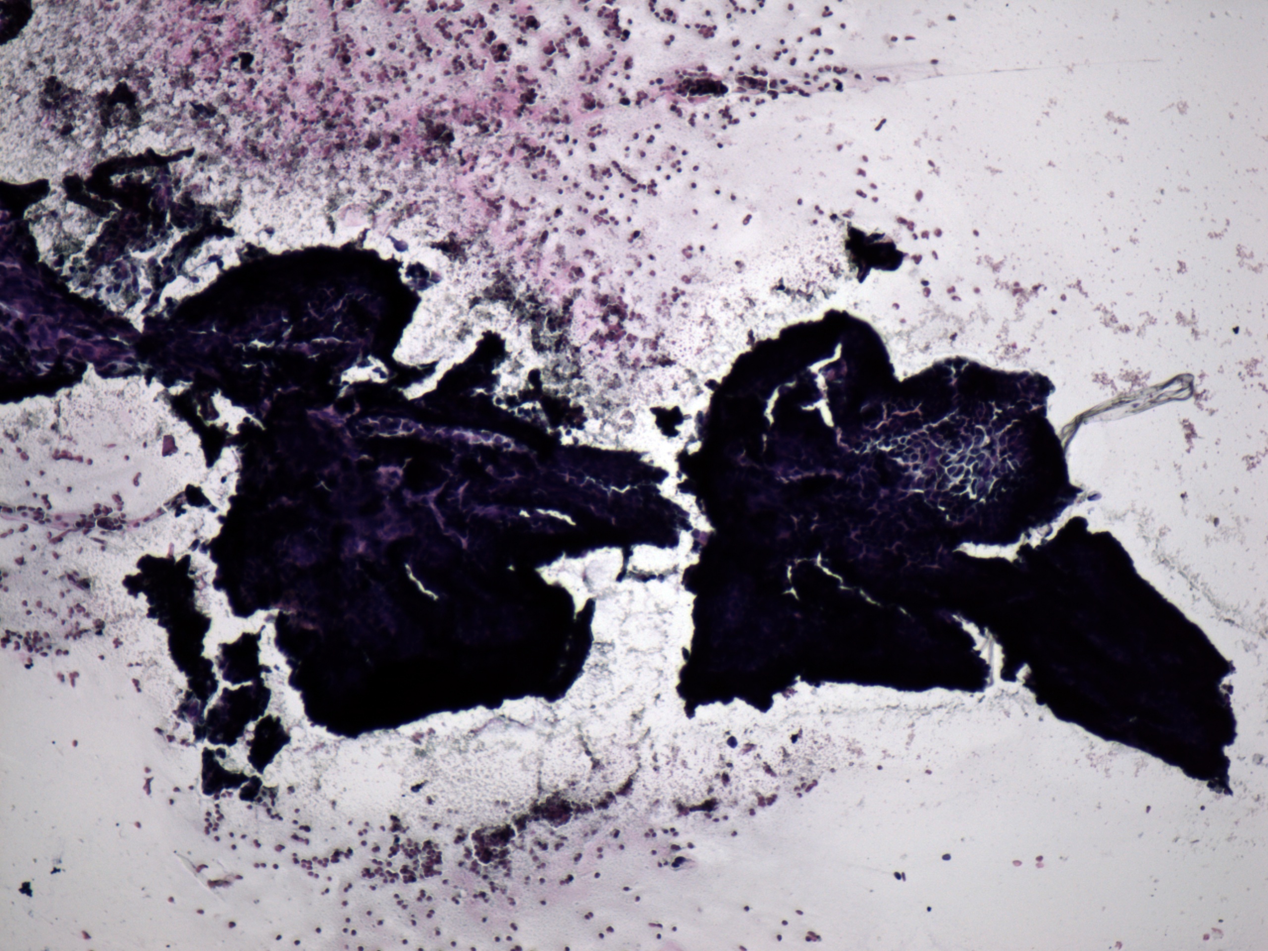 Right lobe, longitudinal scan
