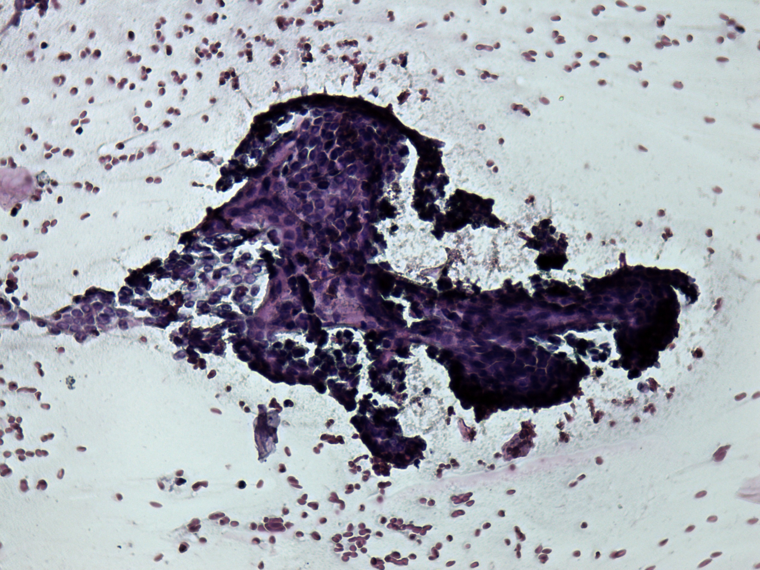 Right lobe, longitudinal scan