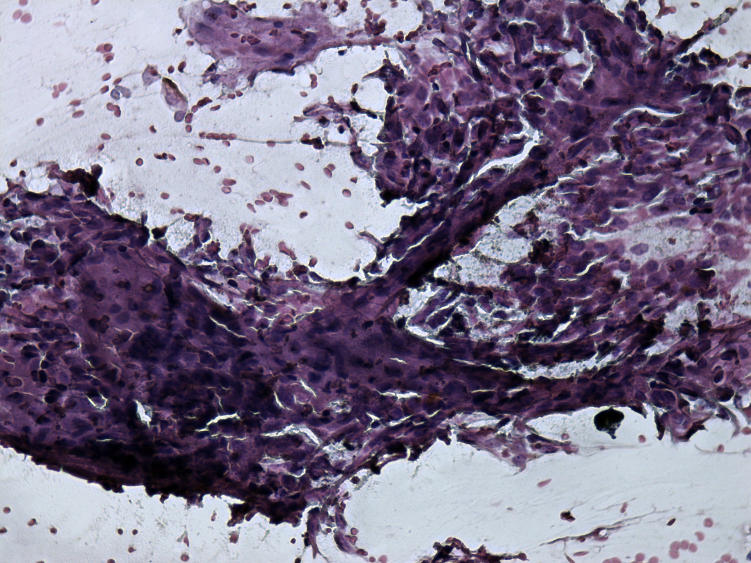 Right lobe, longitudinal scan