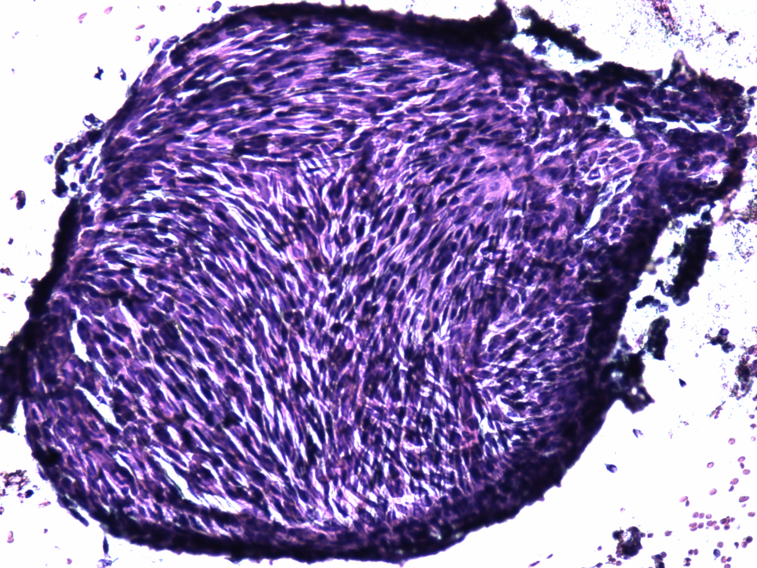 Right lobe, longitudinal scan