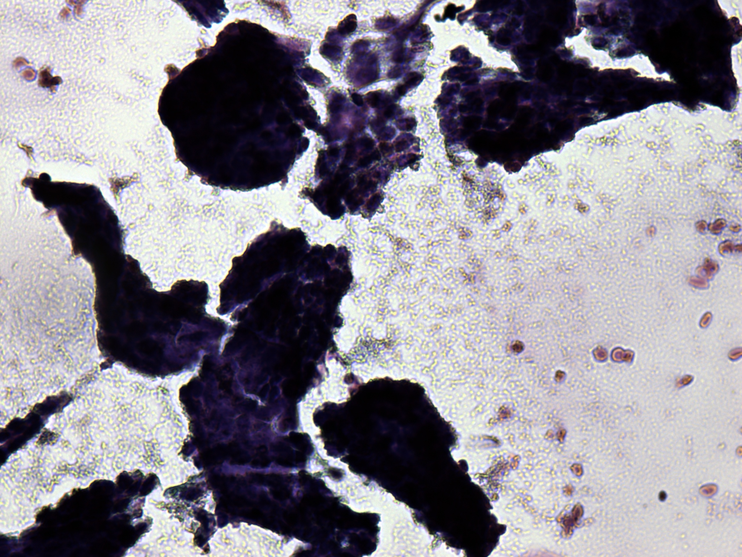 Right lobe, longitudinal scan