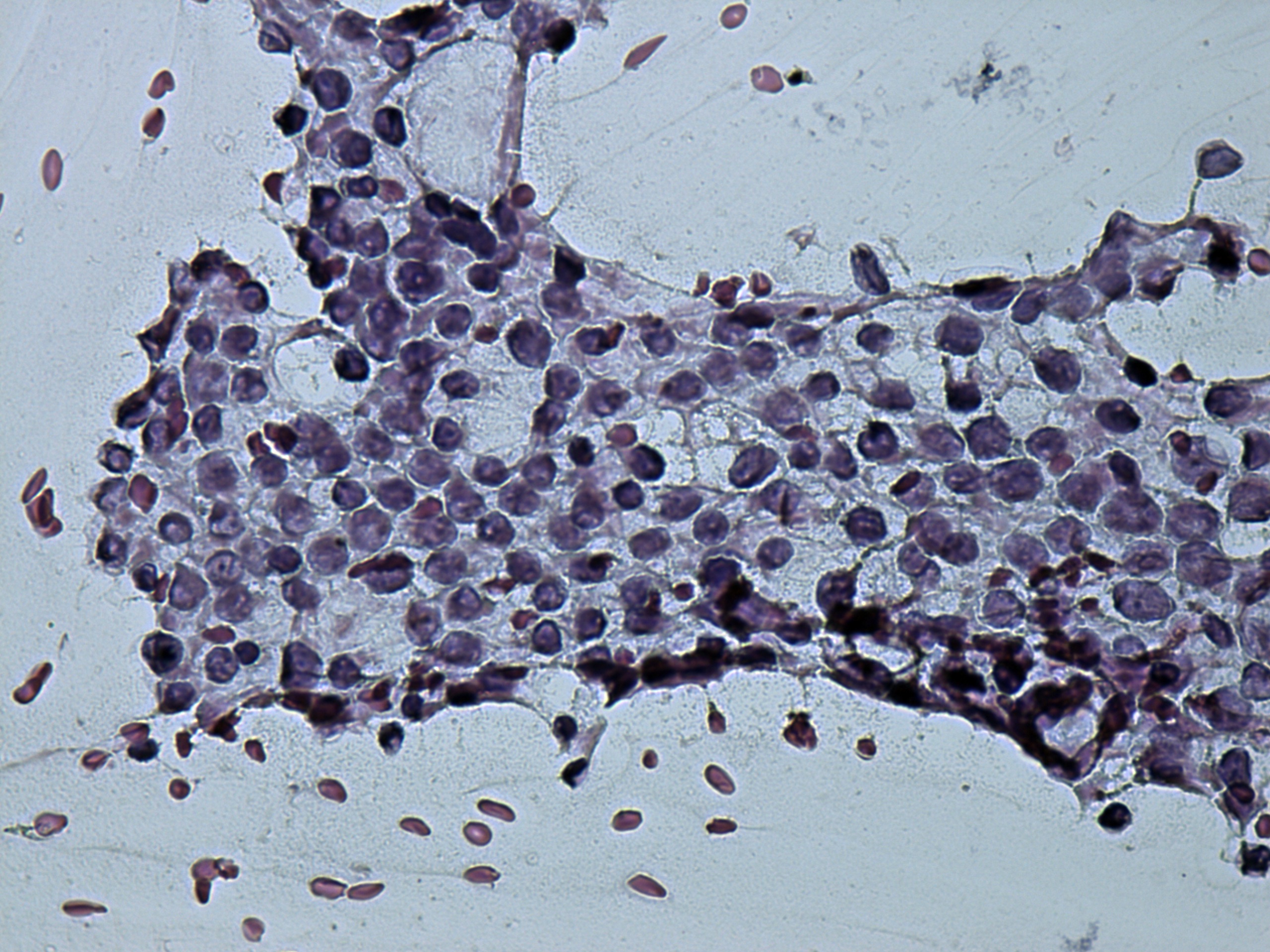 Right lobe, longitudinal scan