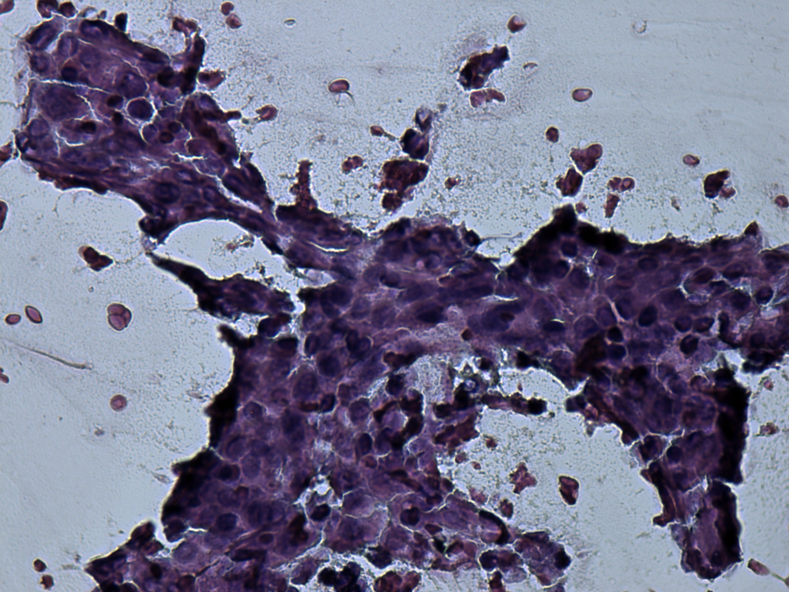 Right lobe, longitudinal scan