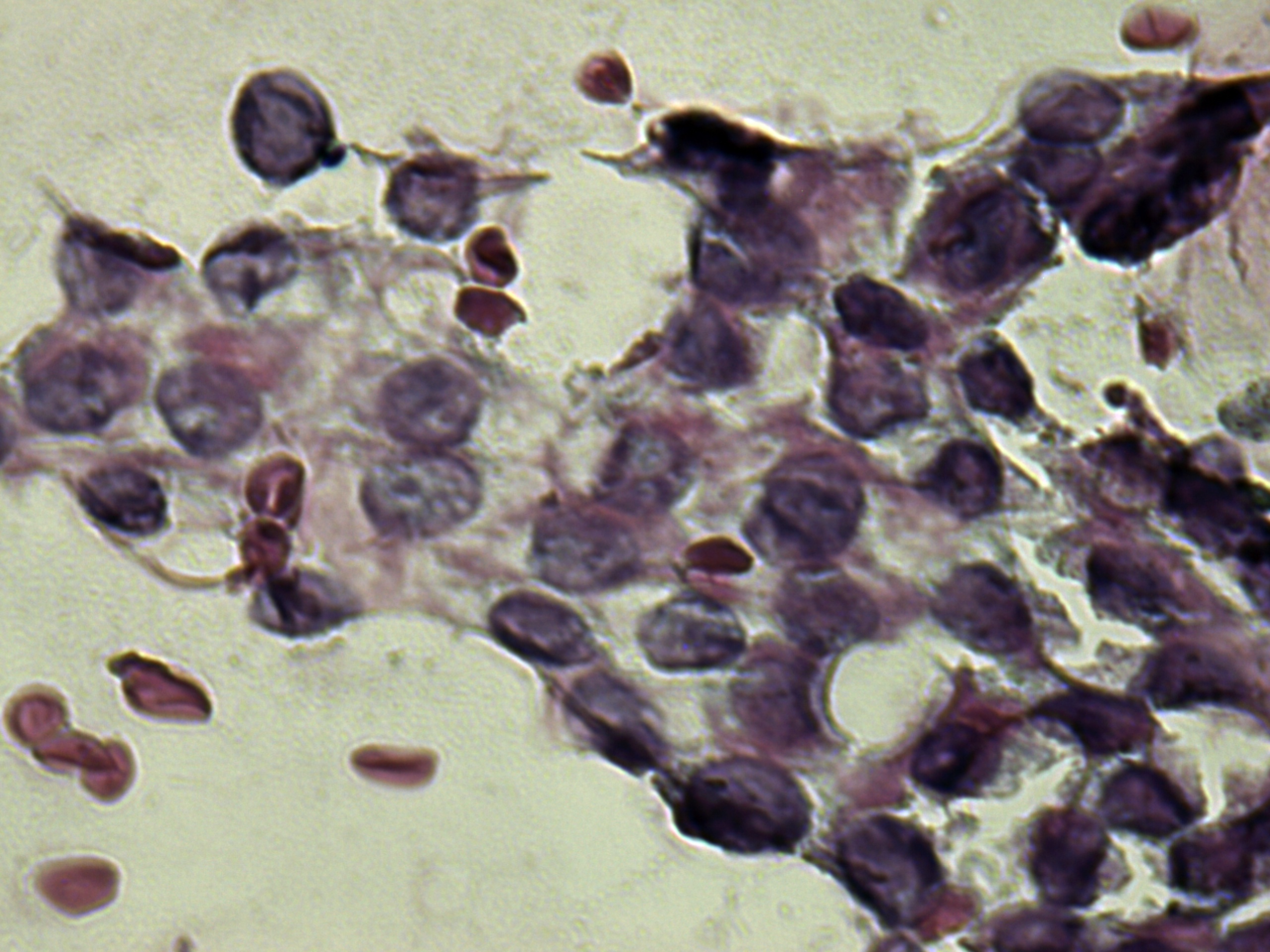 Right lobe, longitudinal scan