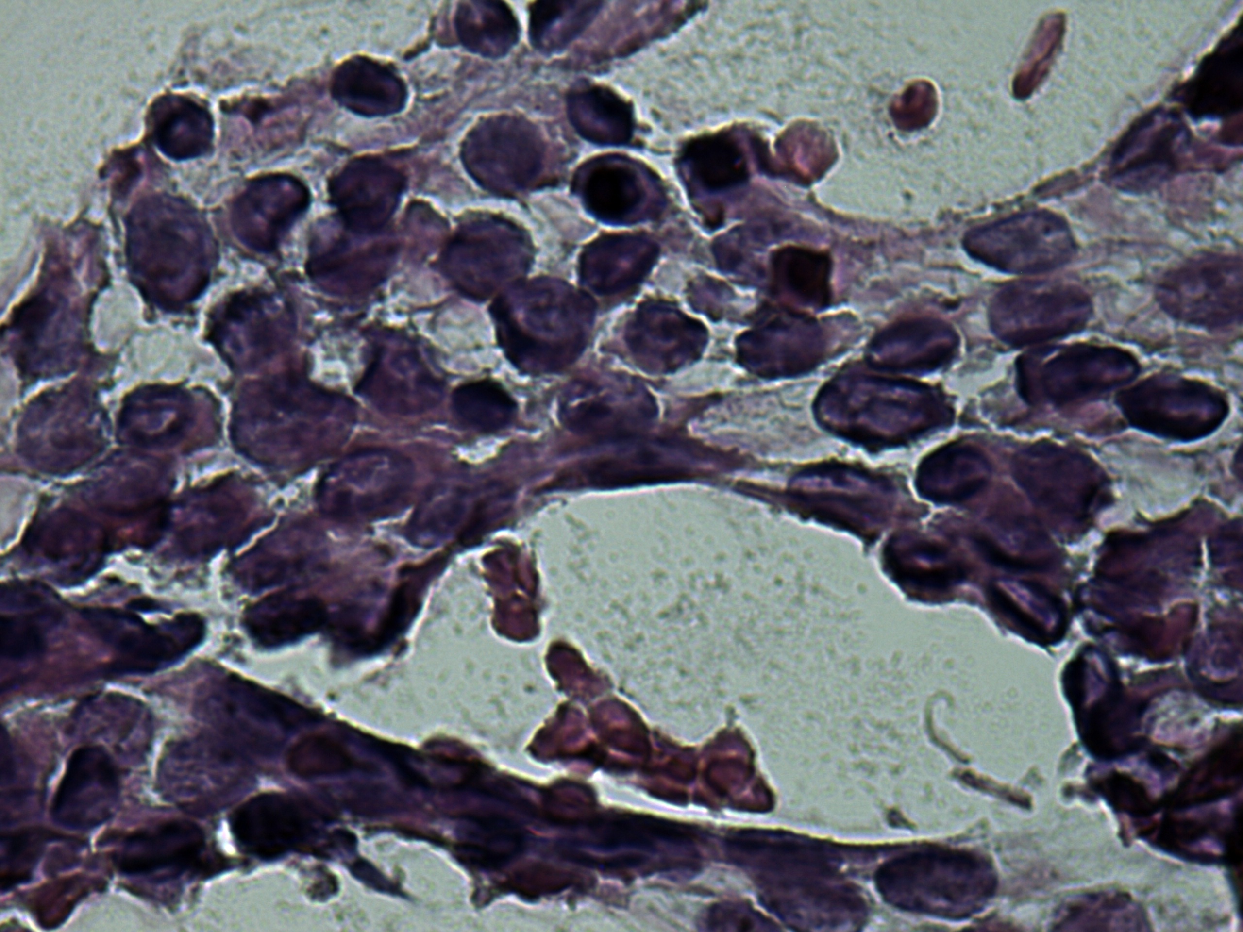 Right lobe, longitudinal scan