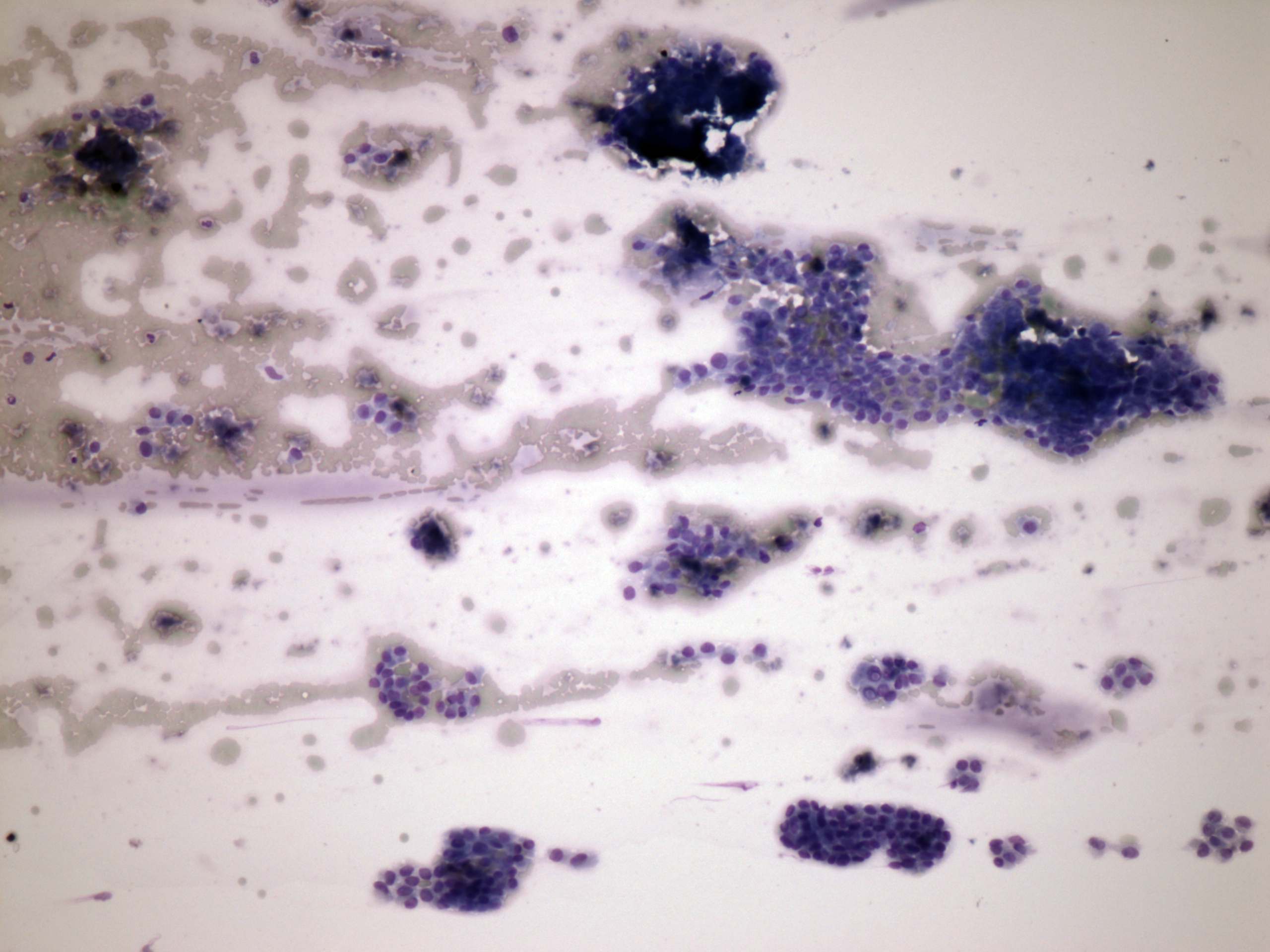 Right lobe, longitudinal scan