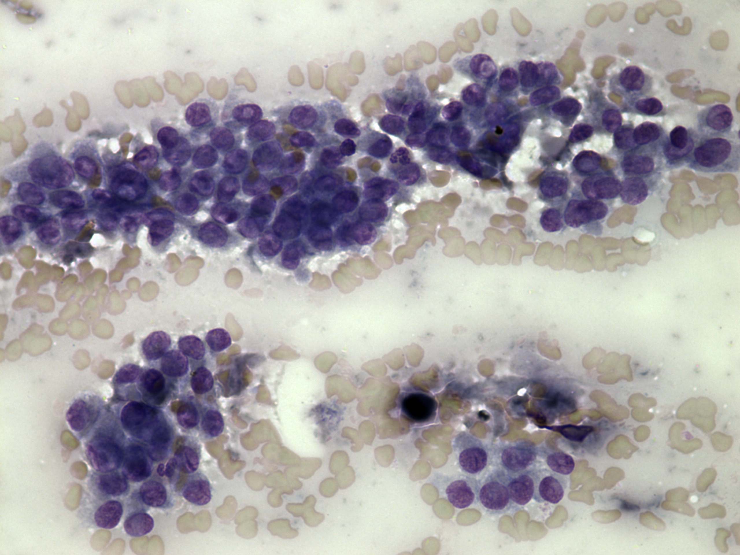 Right lobe, longitudinal scan