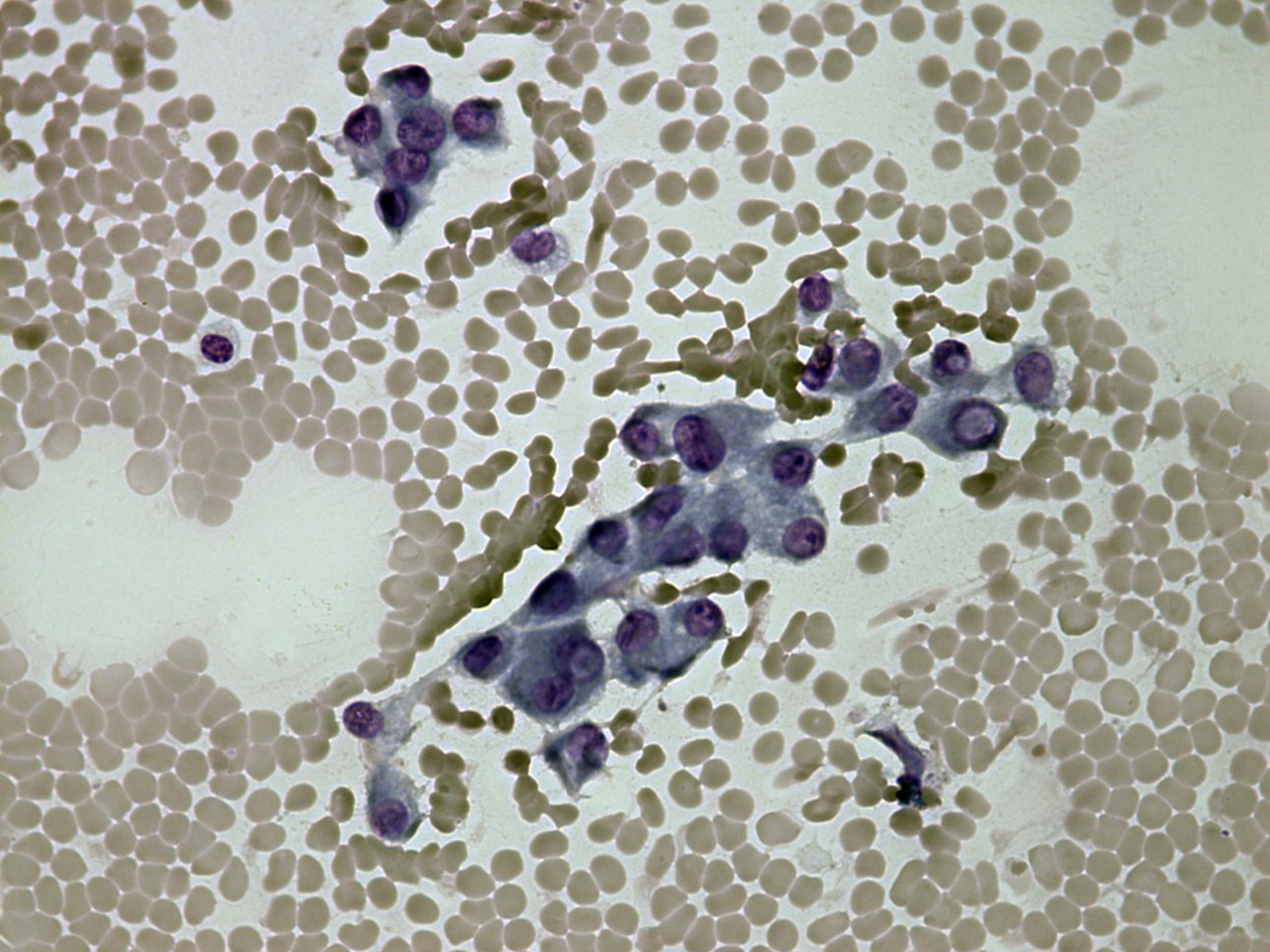 Right lobe, longitudinal scan