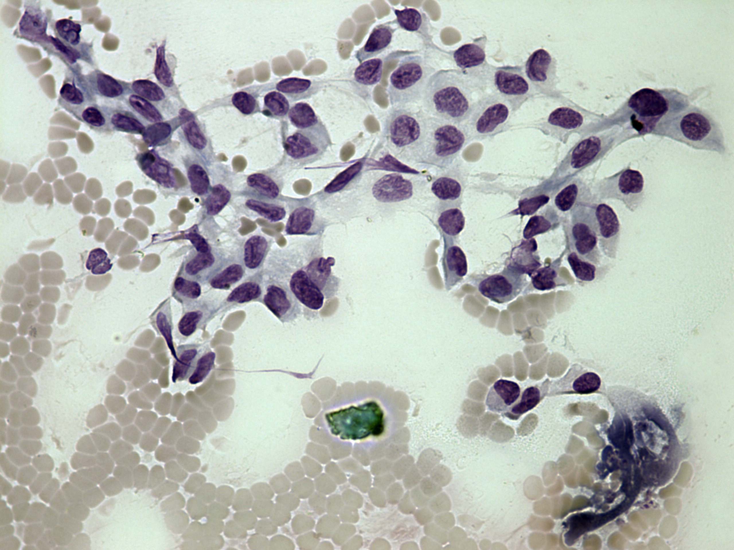 Right lobe, longitudinal scan