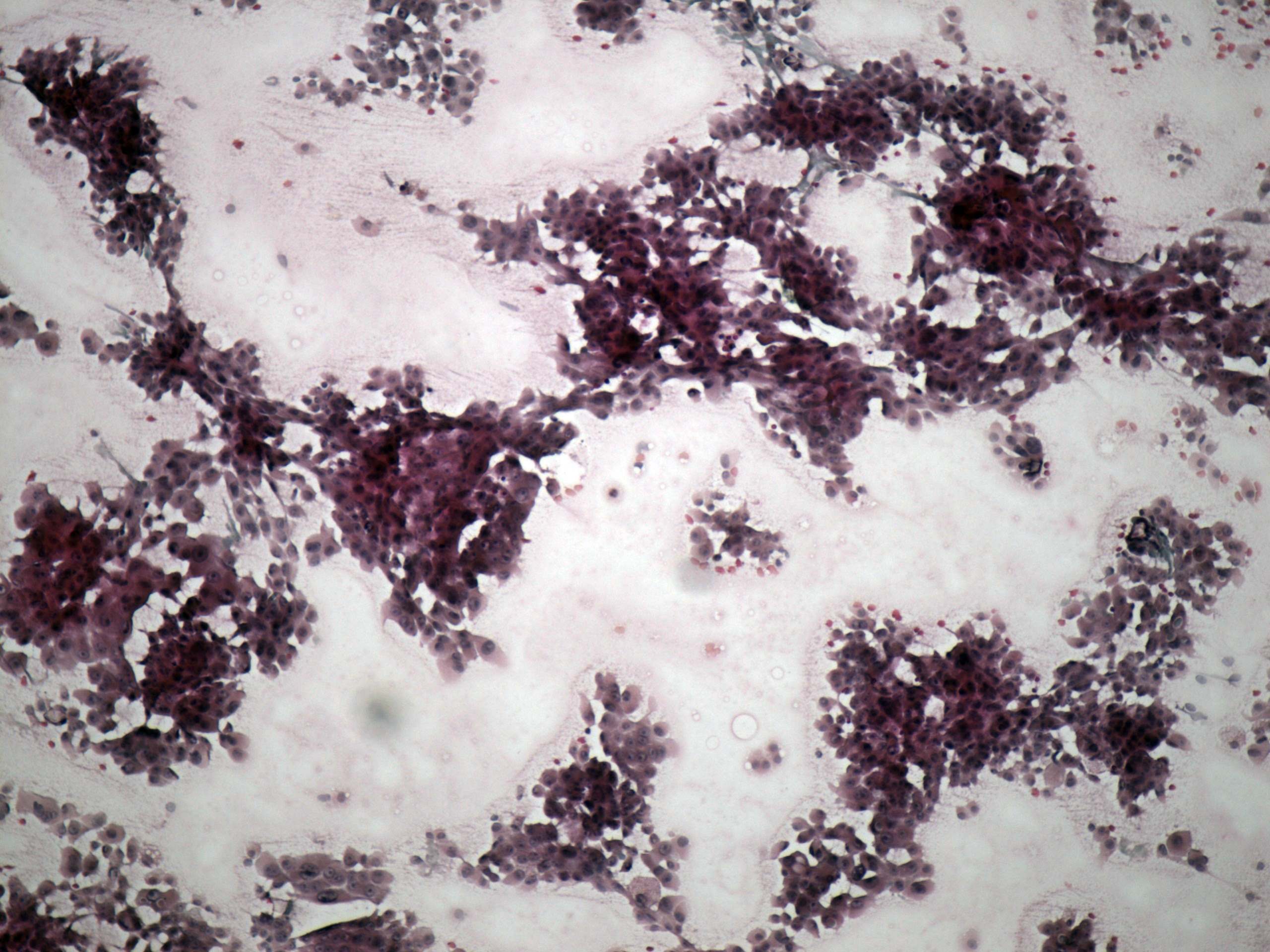 Right lobe, longitudinal scan