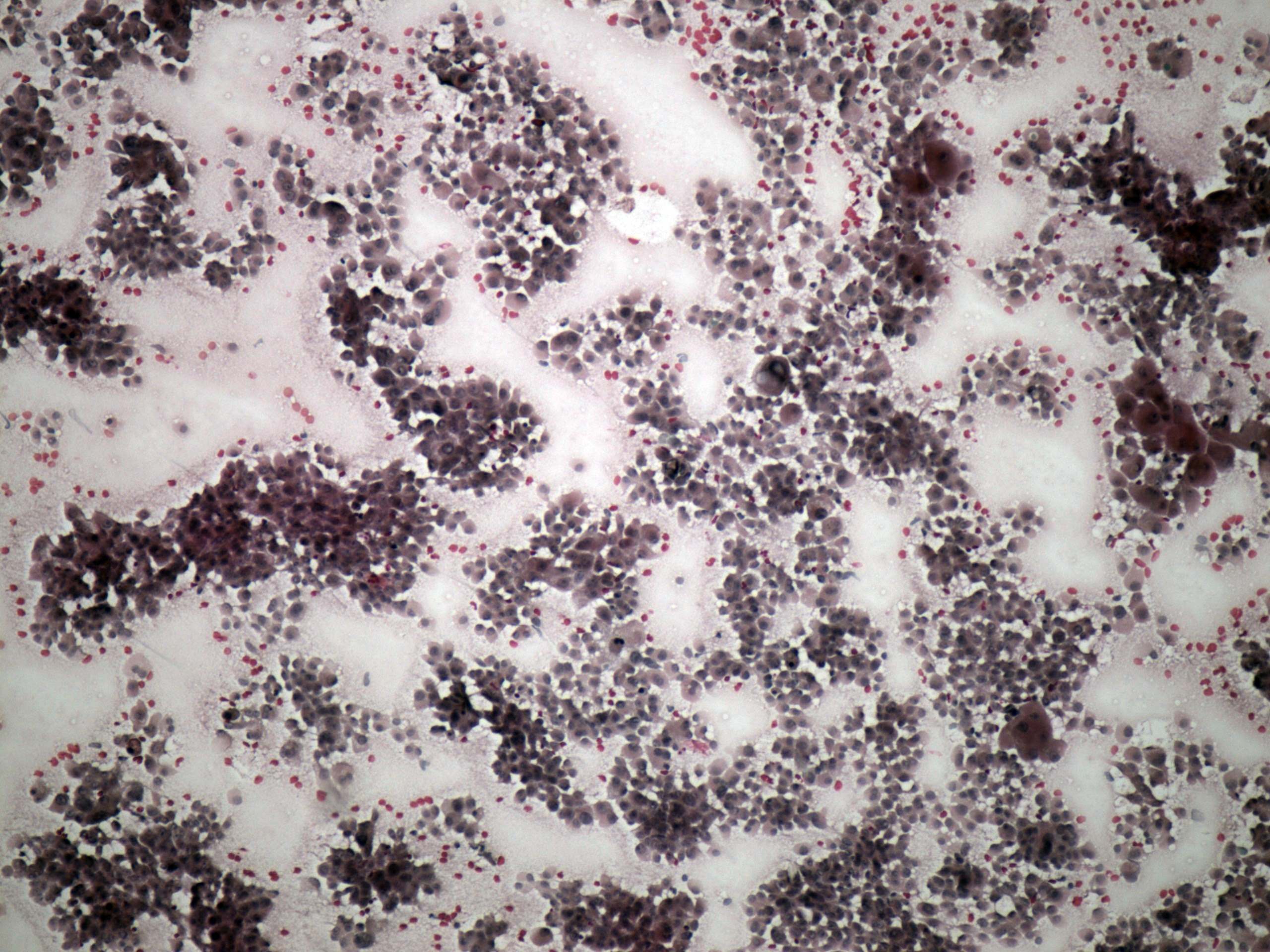 Right lobe, longitudinal scan