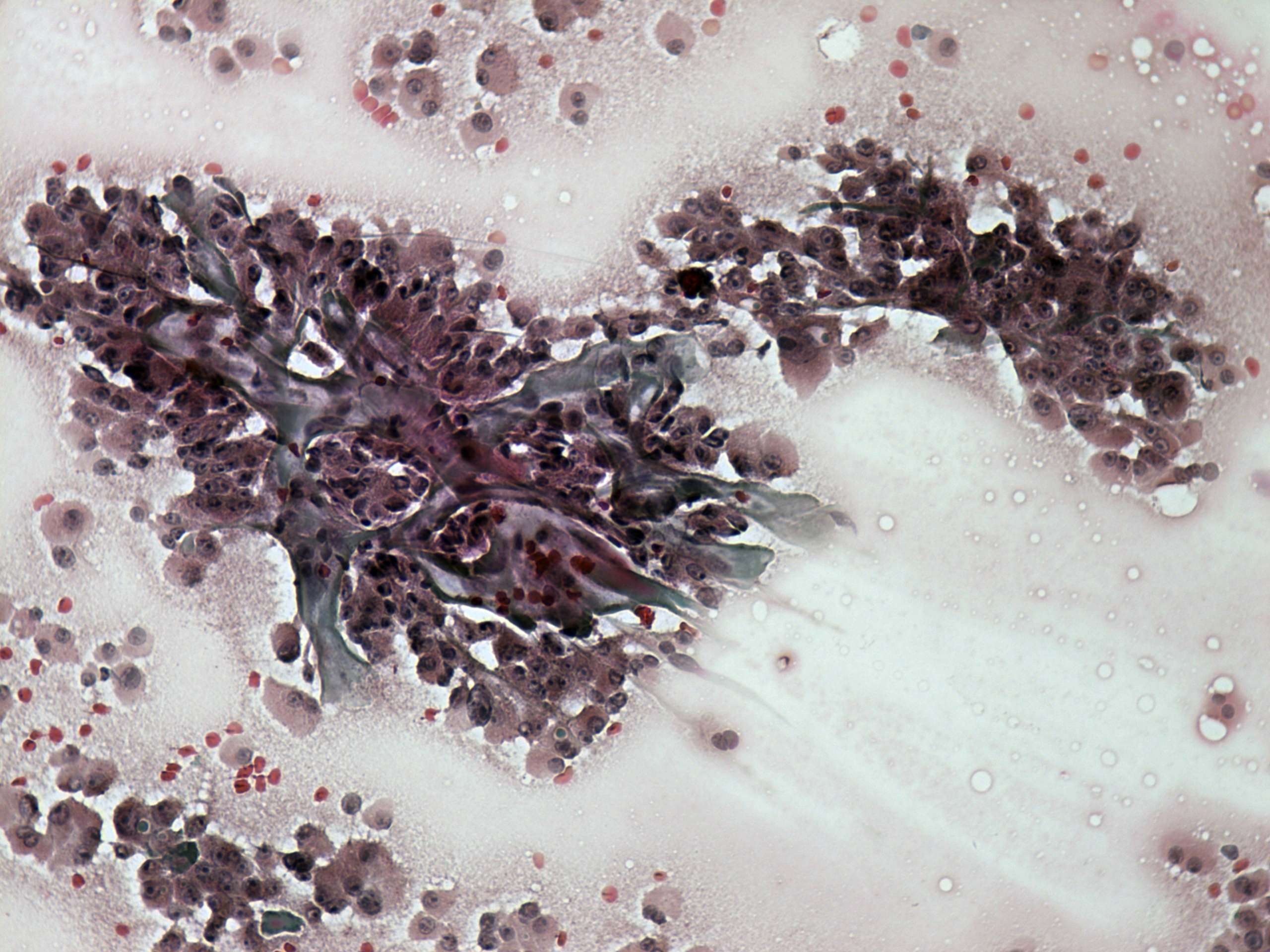 Right lobe, longitudinal scan