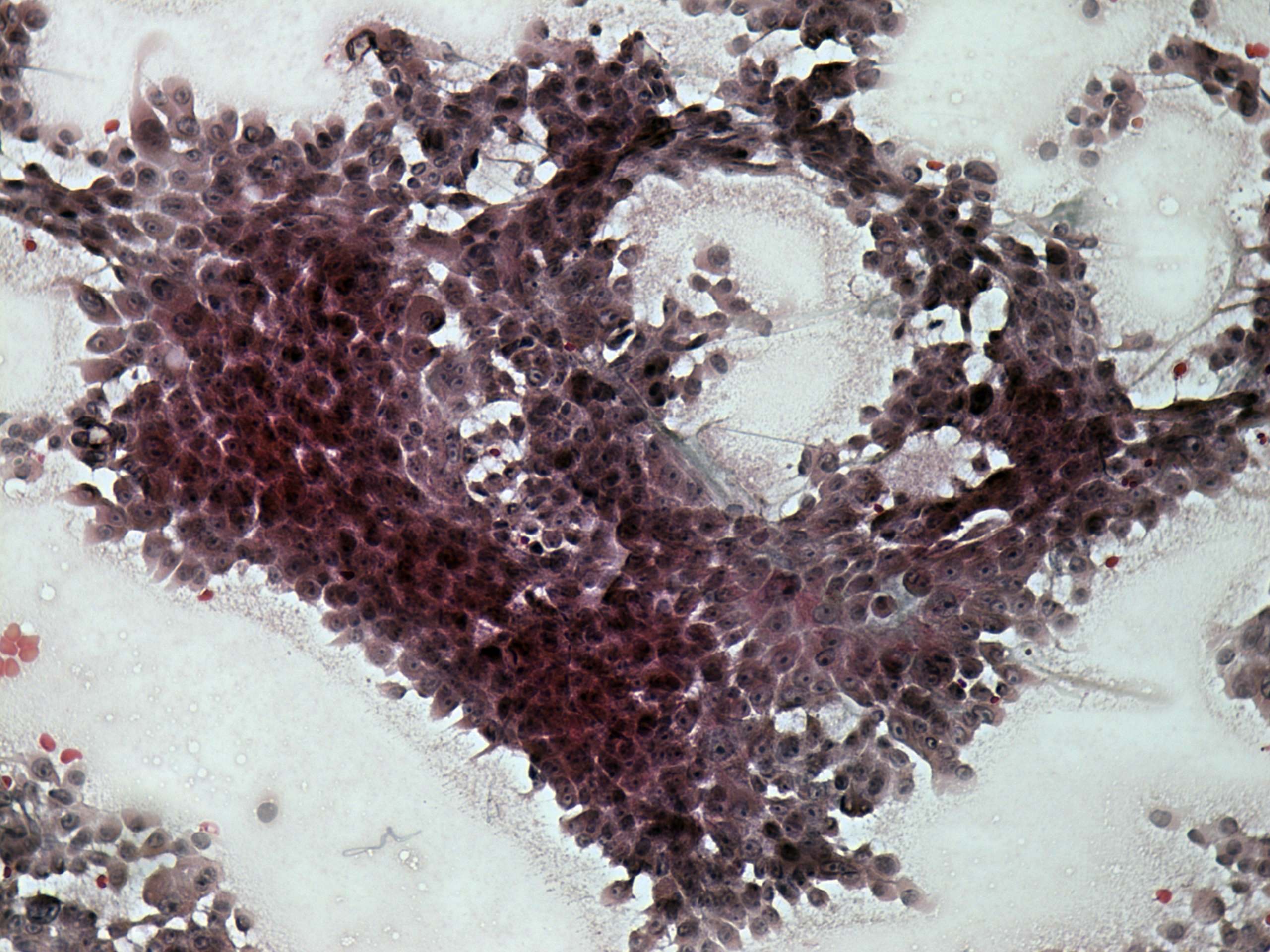 Right lobe, longitudinal scan