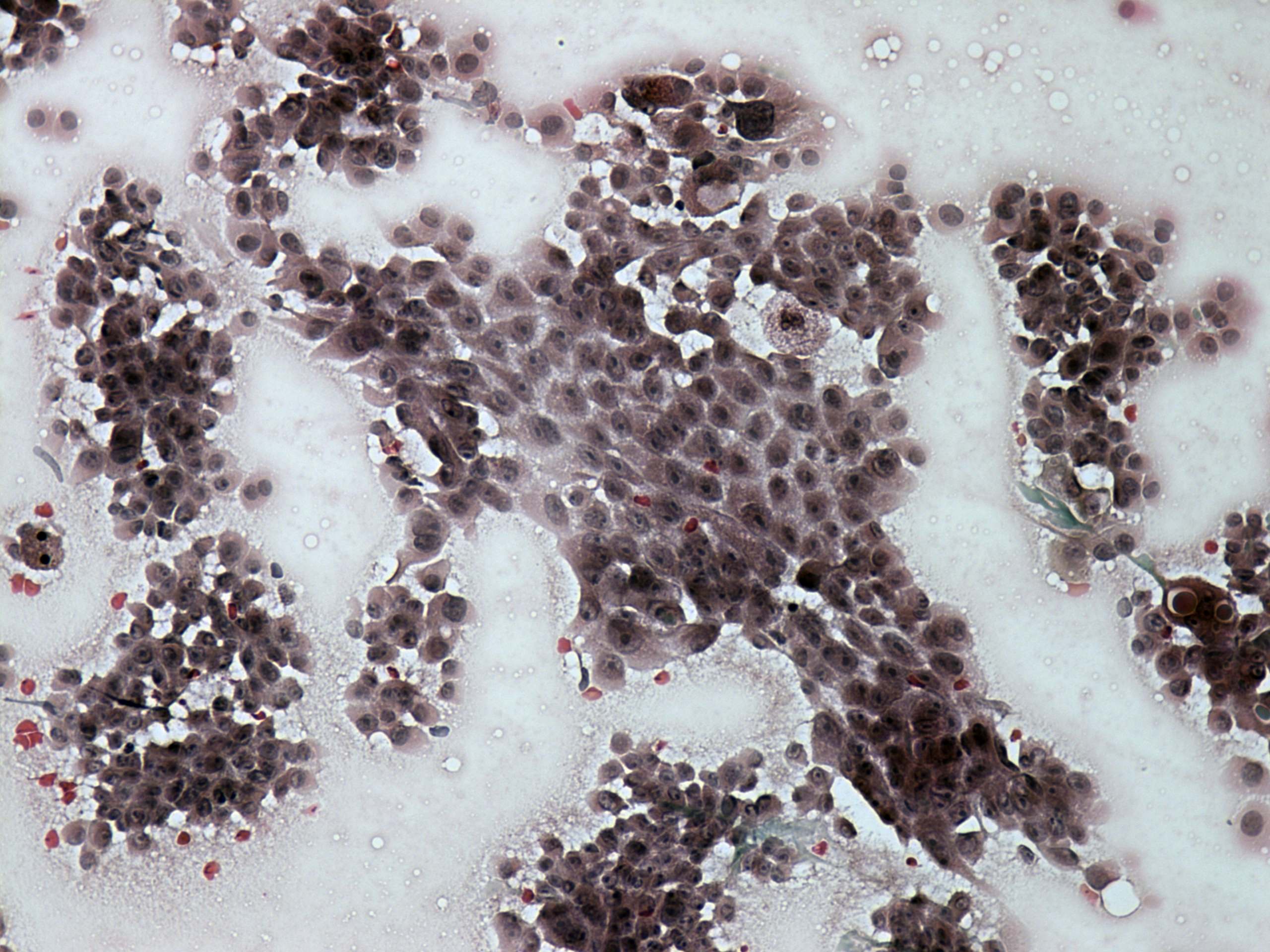 Right lobe, longitudinal scan