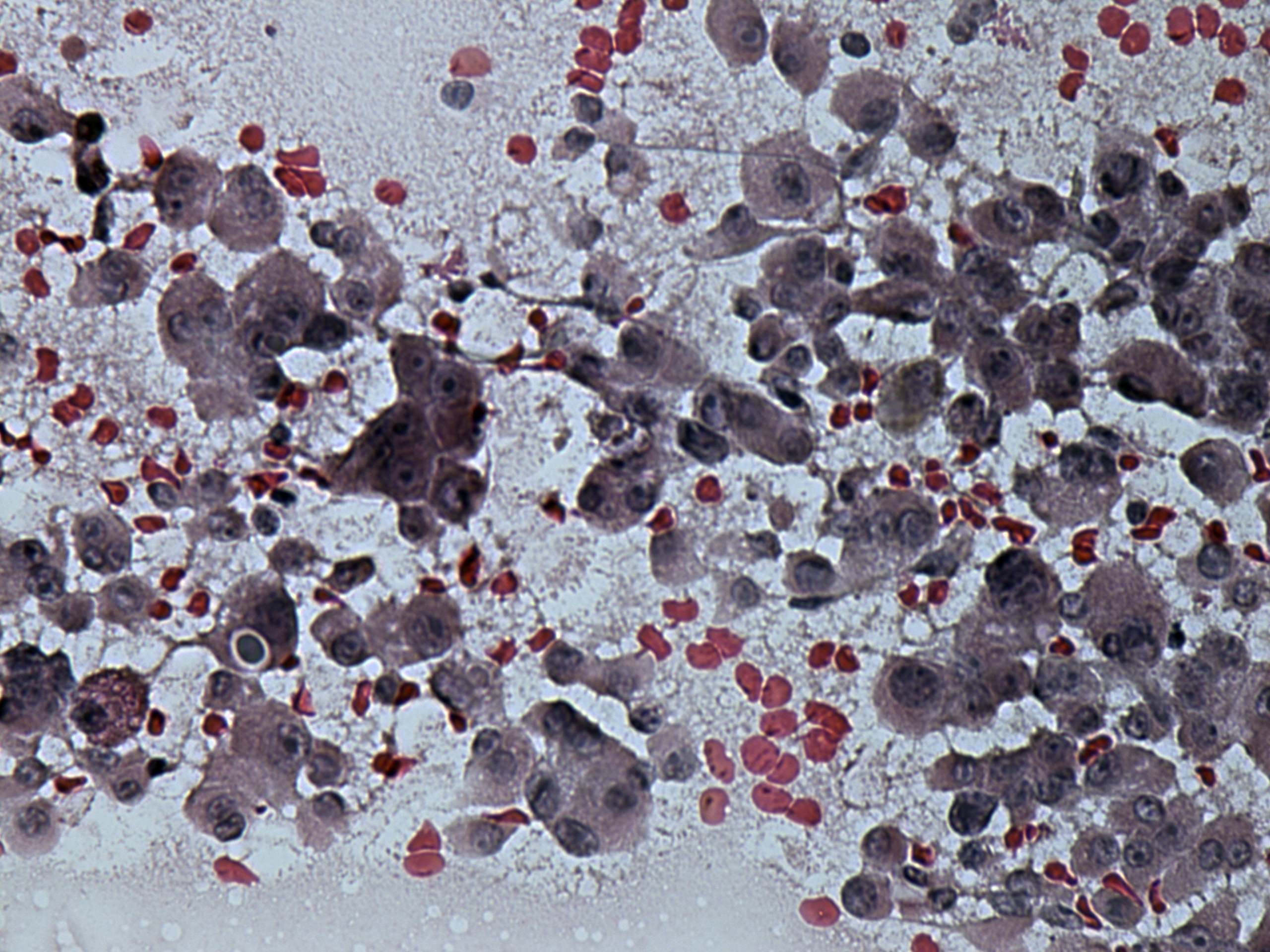 Right lobe, longitudinal scan