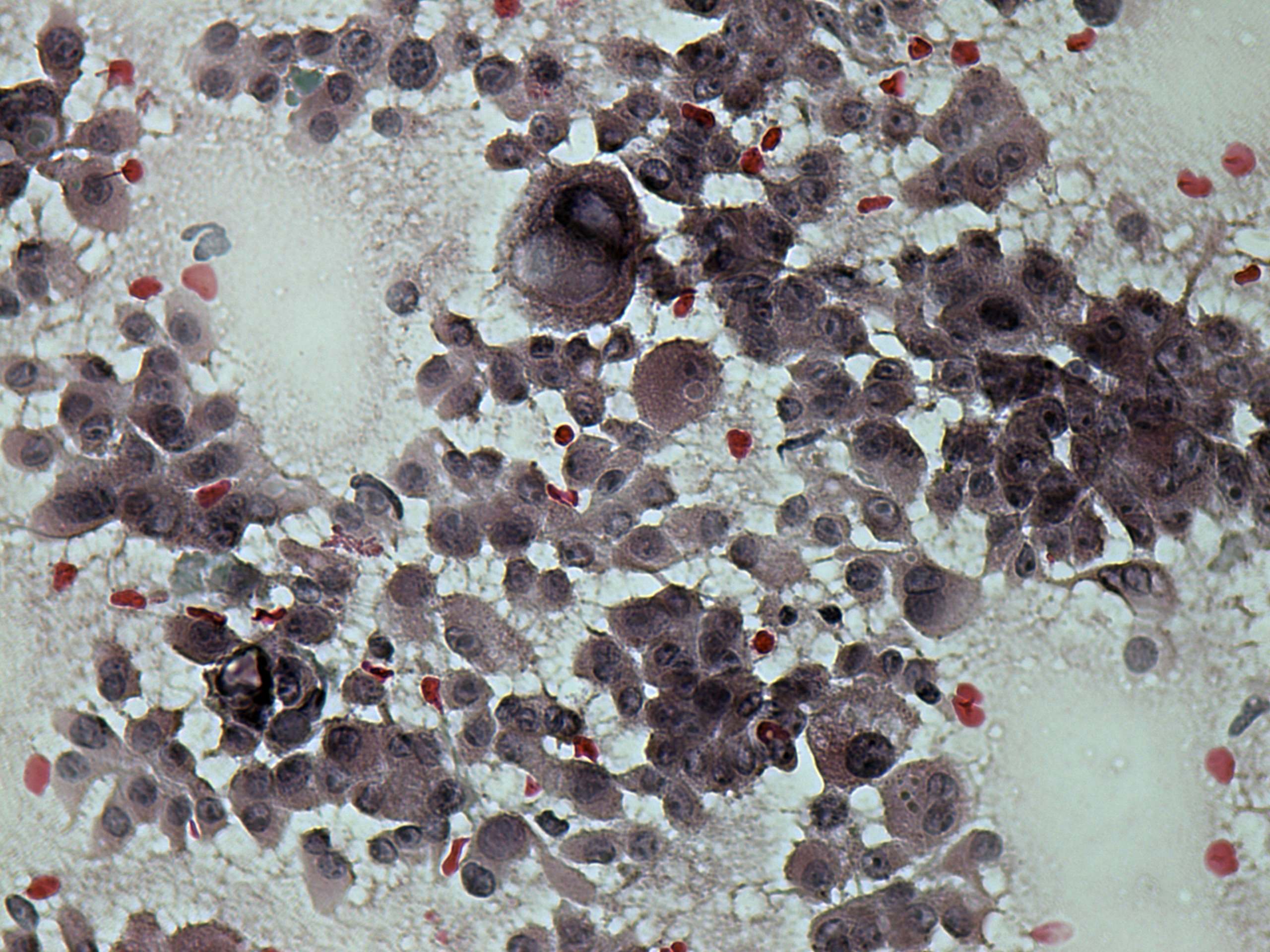 Right lobe, longitudinal scan