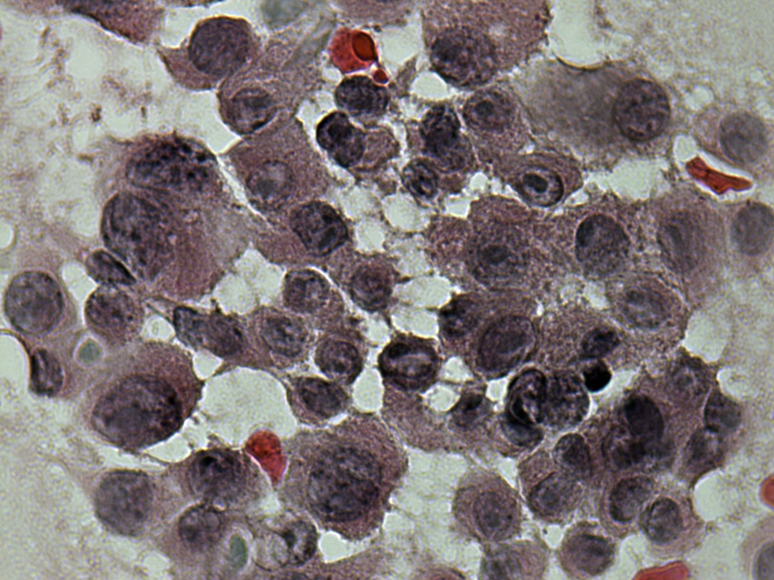 Right lobe, longitudinal scan