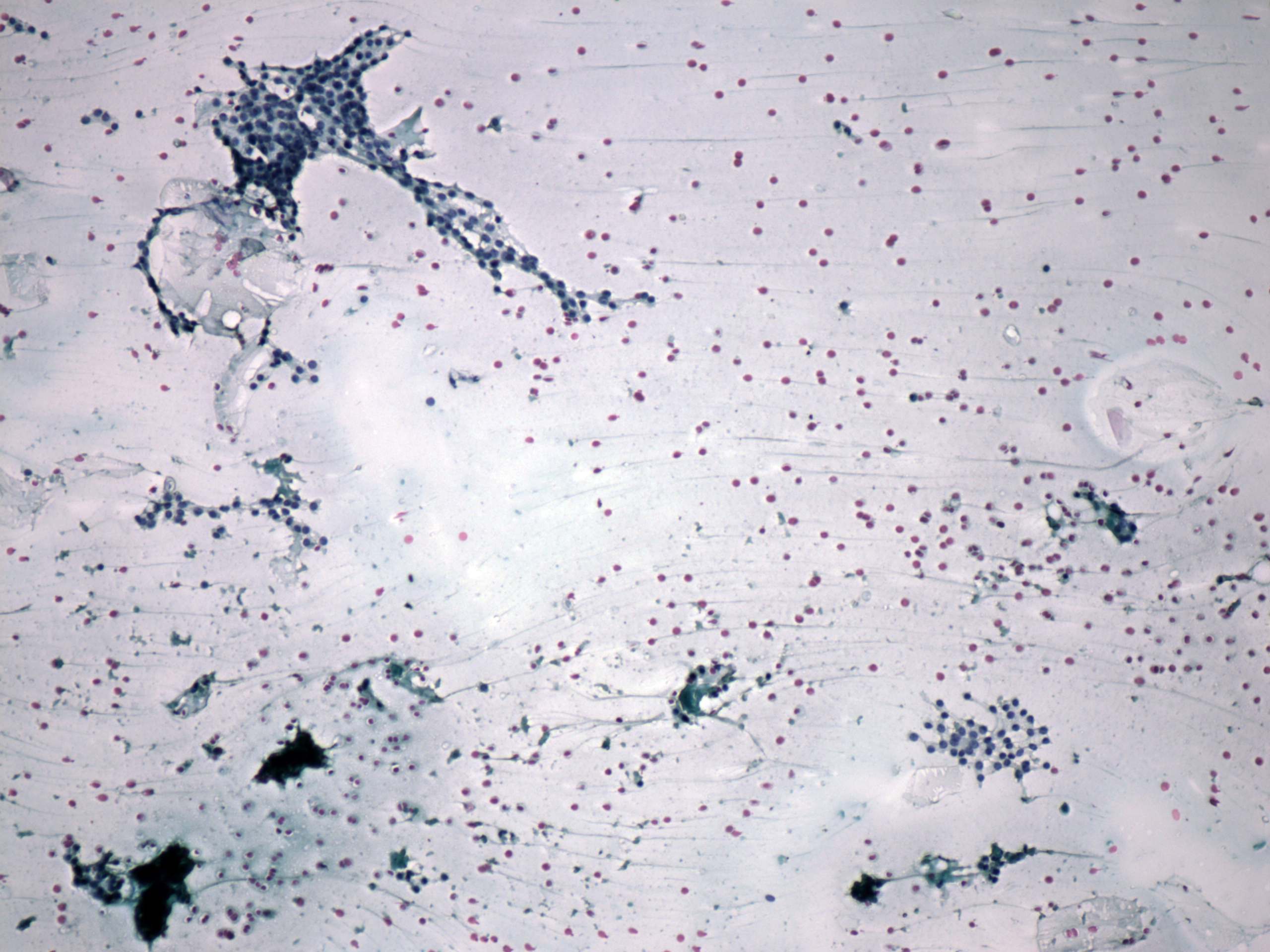 Right lobe, longitudinal scan