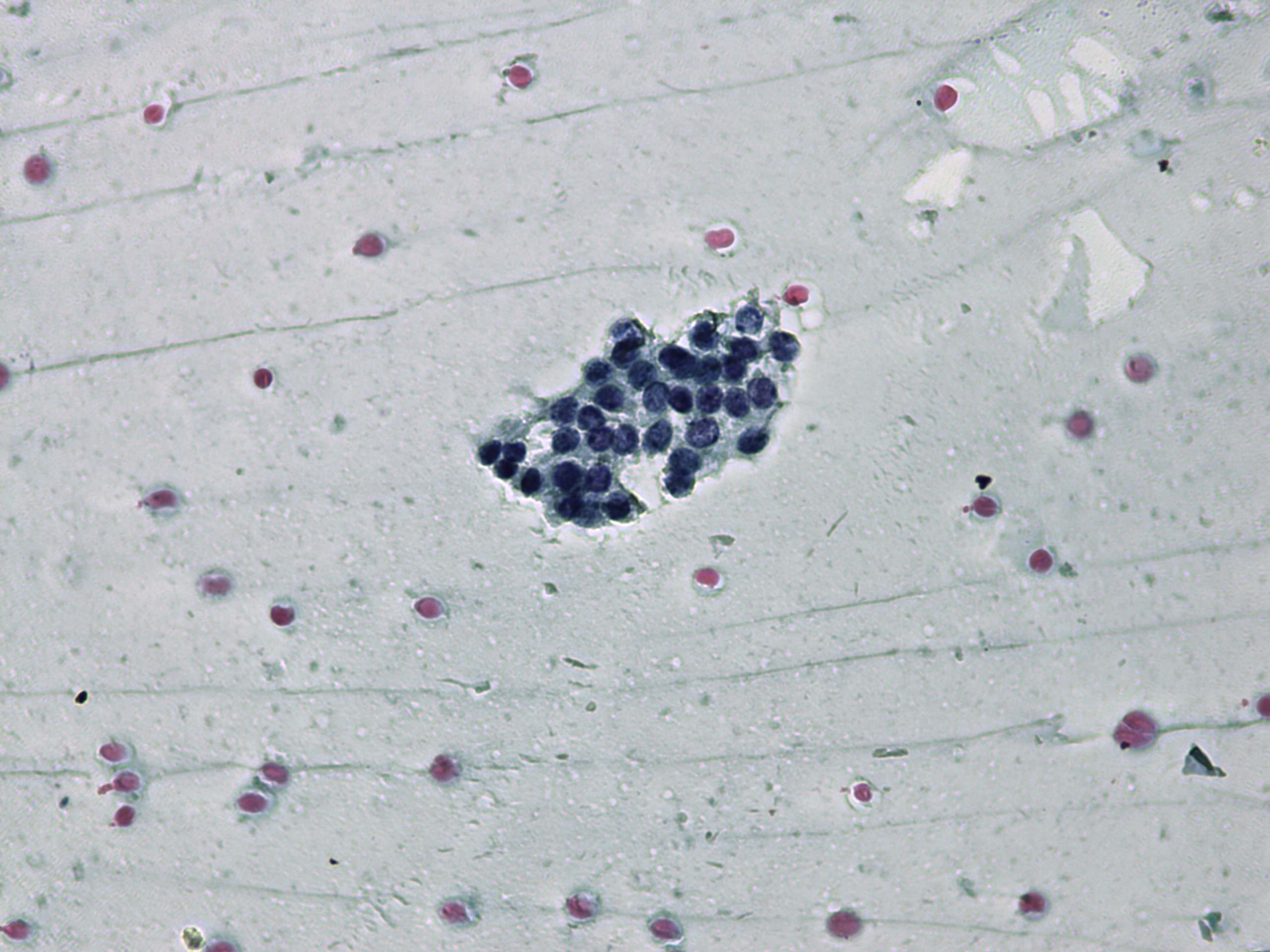 Right lobe, longitudinal scan