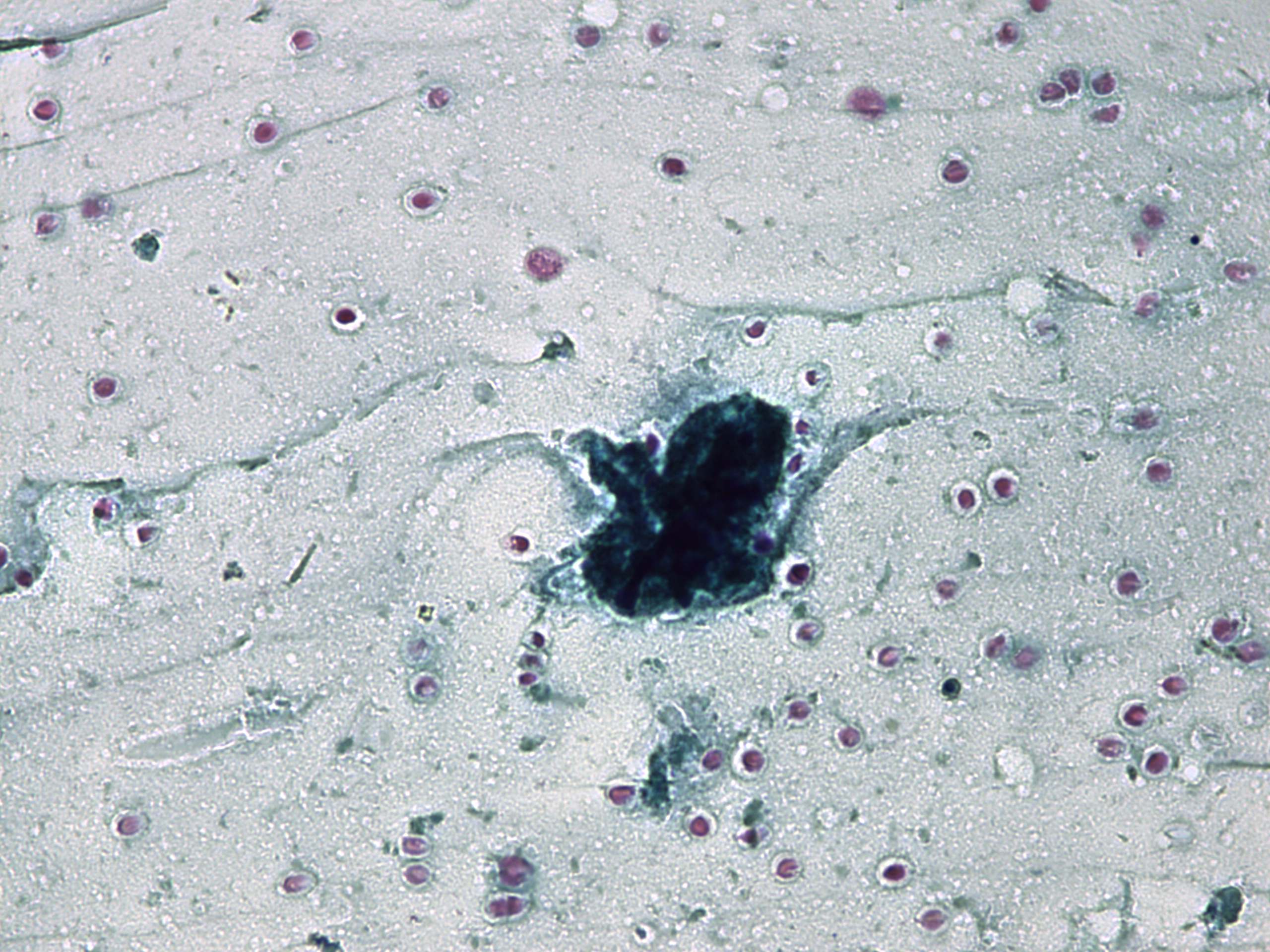 Right lobe, longitudinal scan