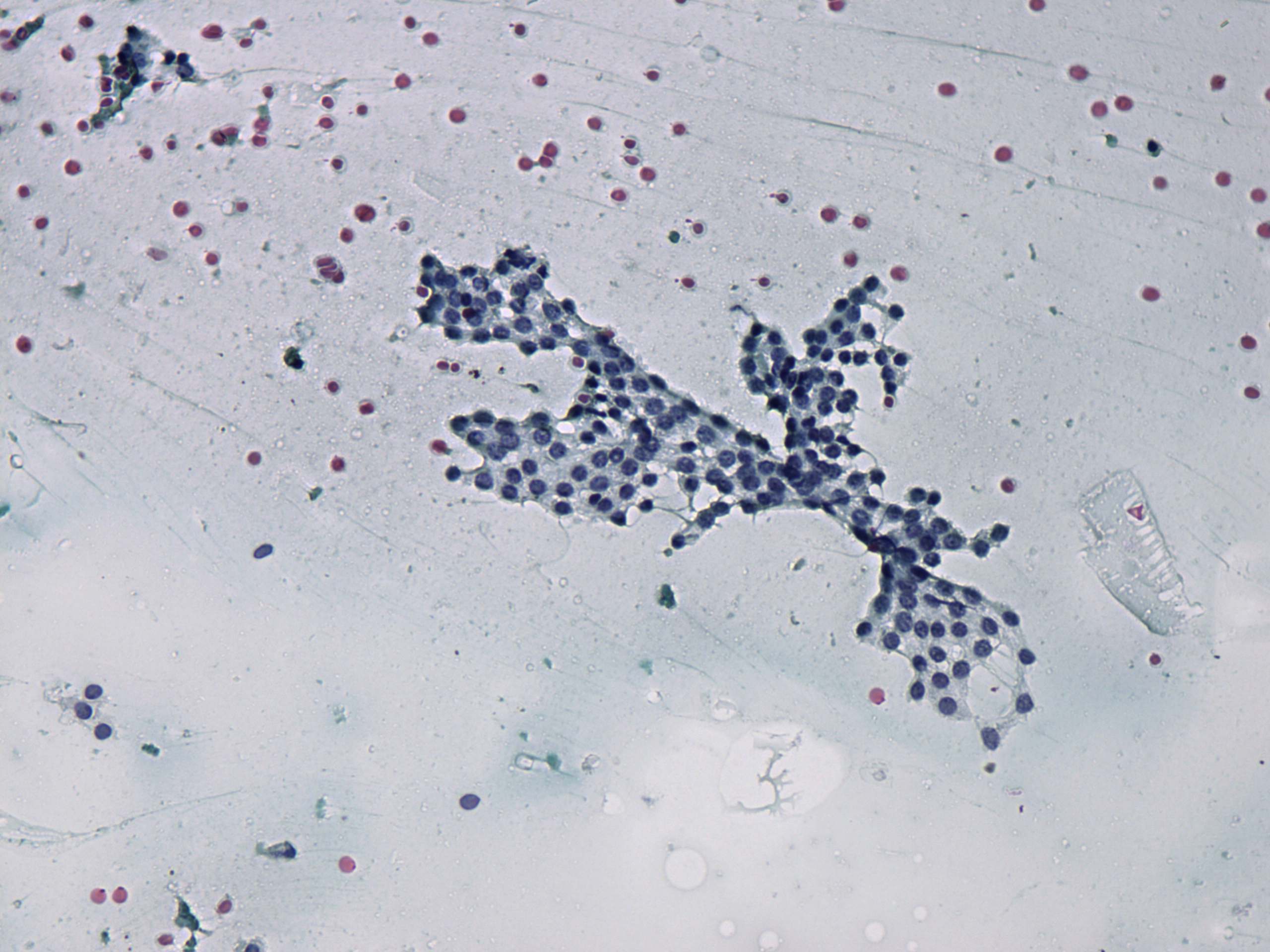 Right lobe, longitudinal scan